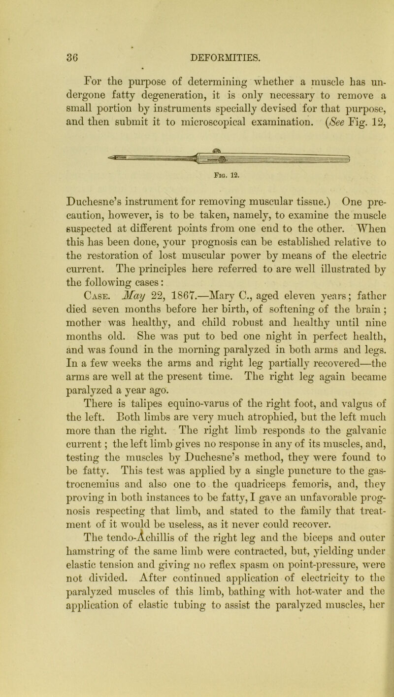 For the purpose of determining whether a muscle has un- dergone fatty degeneration, it is only necessary to remove a small portion by instruments specially devised for that purpose, and then submit it to microscopical examination. (See Fig. 12, Fig. 12. Duchesne’s instrument for removing muscular tissue.) One pre- caution, however, is to be taken, namely, to examine the muscle suspected at different points from one end to the other. When this has been done, your prognosis can be established relative to the restoration of lost muscular power by means of the electric current. The principles here referred to are well illustrated by the following cases: Case. May 22, 1867.—Mary C., aged eleven years; father died seven months before her birth, of softening of the brain; mother was healthy, and child robust and healthy until nine months old. She was put to bed one night in perfect health, and was found in the morning paralyzed in both arms and legs. In a few weeks the arms and right leg partially recovered—the arms are well at the present time. The right leg again became paralyzed a year ago. There is talipes equino-varus of the right foot, and valgus of the left. Both limbs are very much atrophied, but the left much more than the right. The right limb responds to the galvanic current; the left limb gives no response in any of its muscles, and, testing the muscles by Duchesne’s method, they were found to be fatty. This test was applied by a single puncture to the gas- trocnemius and also one to the quadriceps femoris, and, they proving in both instances to be fatty, I gave an unfavorable prog- nosis respecting that limb, and stated to the family that treat- ment of it would be useless, as it never could recover. The tendo-Achillis of the right leg and the biceps and outer hamstring of the same limb were contracted, but, yielding under elastic tension and giving no reflex spasm on point-pressure, were not divided. After continued application of electricity to the paralyzed muscles of this limb, bathing with hot-water and the application of elastic tubing to assist the paralyzed muscles, her