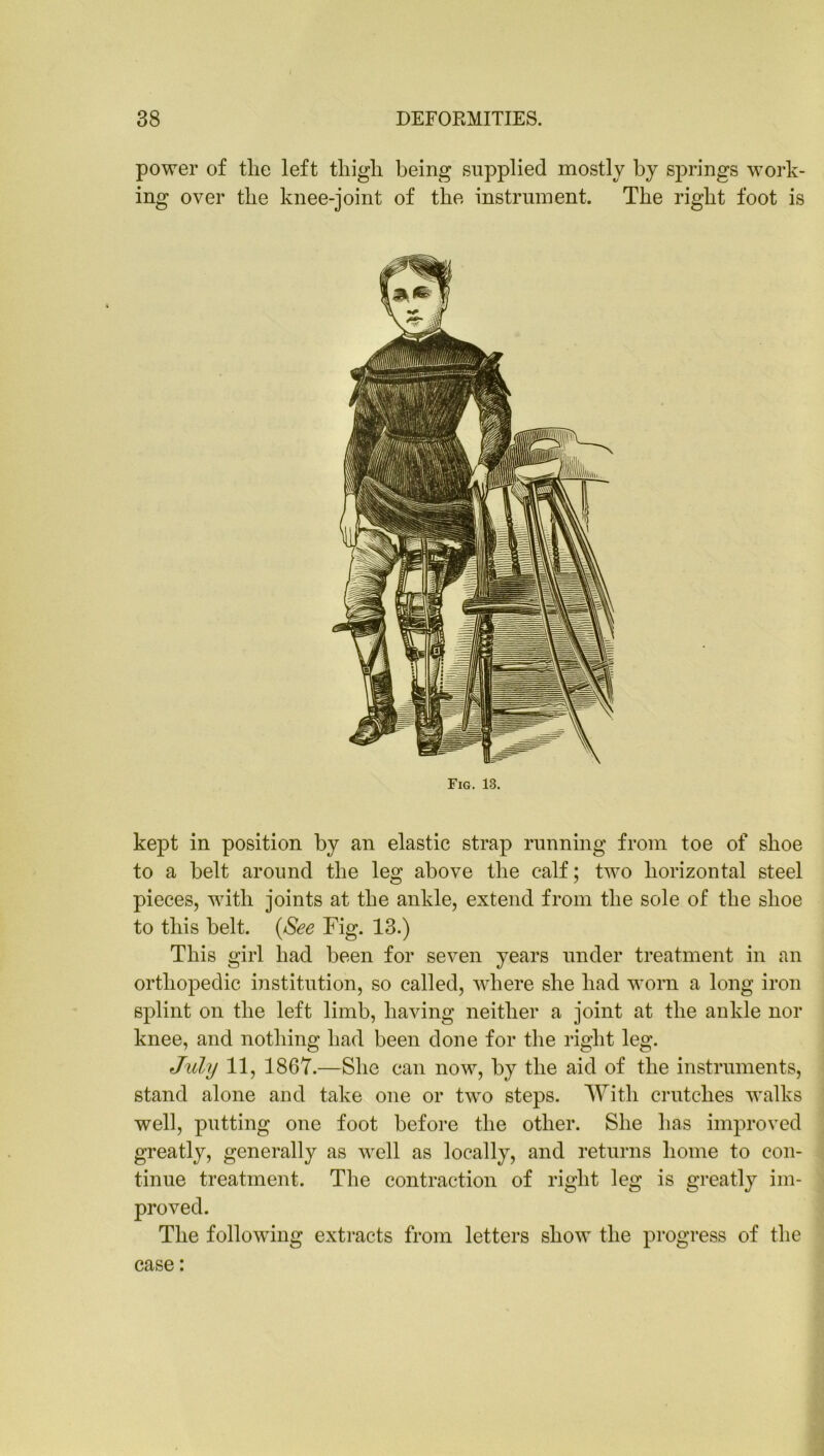 power of tlie left tliigli being supplied mostly by springs work- ing over the knee-joint of the instrument. The right foot is Fig. 13. kept in position by an elastic strap running from toe of shoe to a belt around the leg above the calf; two horizontal steel pieces, with joints at the ankle, extend from the sole of the shoe to this belt. {See Fig. 13.) This girl had been for seven years under treatment in an orthopedic institution, so called, where she had worn a long iron splint on the left limb, having neither a joint at the ankle nor knee, and nothing had been done for the right leg. July 11, 1867.—She can now, by the aid of the instruments, stand alone and take one or two steps. With crutches walks well, putting one foot before the other. She has improved greatly, generally as well as locally, and returns home to con- tinue treatment. The contraction of right leg is greatly im- proved. The following extracts from letters show the progress of the case: