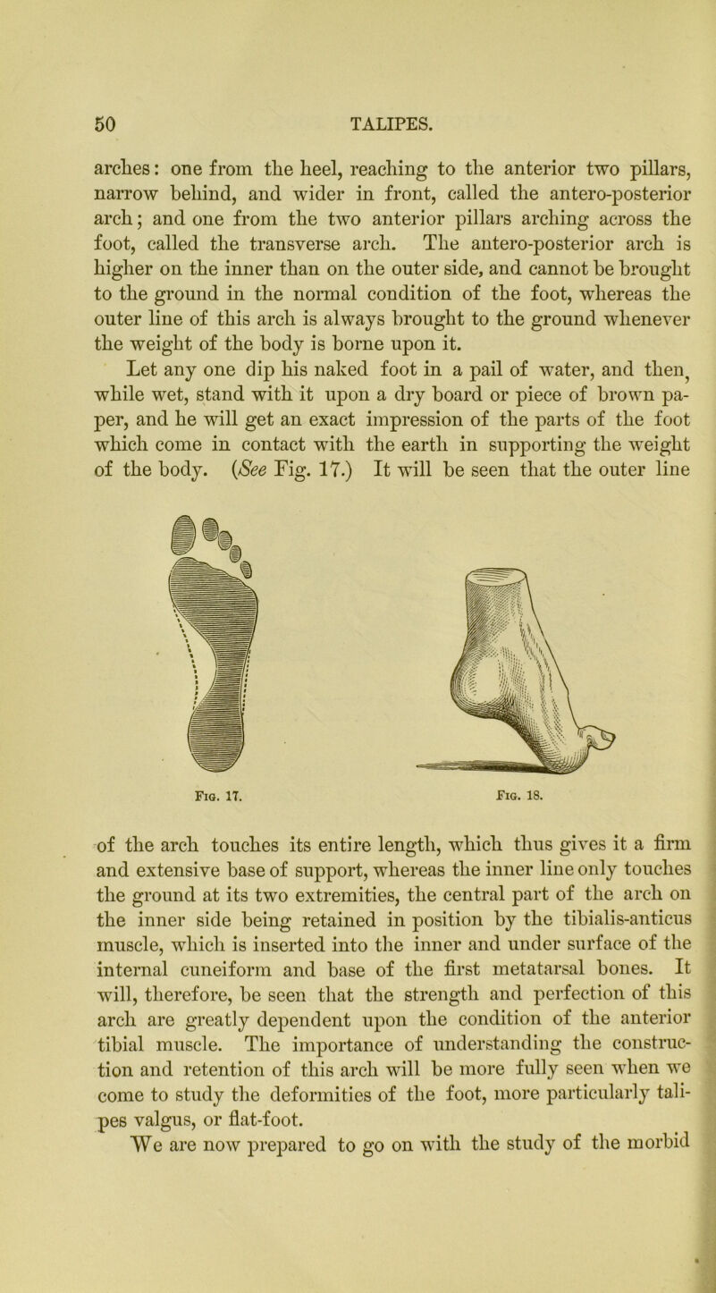 arclies: one from the heel, reaching to the anterior two pillars, narrow behind, and wider in front, called the antero-posterior arch; and one from the two anterior pillars arching across the foot, called the transverse arch. The antero-posterior arch is higher on the inner than on the outer side, and cannot be brought to the ground in the normal condition of the foot, whereas the outer line of this arch is always brought to the ground whenever the weight of the body is borne upon it. Let any one dip his naked foot in a pail of water, and then,, while wet, stand with it upon a dry hoard or piece of brown pa- per, and he will get an exact impression of the parts of the foot which come in contact with the earth in supporting the weight of the body. {See Fig. 17.) It will be seen that the outer line Fig. IT. Fig. 18. of the arch touches its entire length, which thus gives it a firm and extensive base of support, whereas the inner line only touches the ground at its two extremities, the central part of the arch on the inner side being retained in position by the tibialis-anticus muscle, which is inserted into the inner and under surface of the internal cuneiform and base of the first metatarsal bones. It will, therefore, be seen that the strength and perfection of this arch are greatly dependent upon the condition of the anterior tibial muscle. The importance of understanding the construc- tion and retention of this arch will be more fully seen when we come to study the deformities of the foot, more particularly tali- pes valgus, or flat-foot. We are now prepared to go on with the study of the morbid