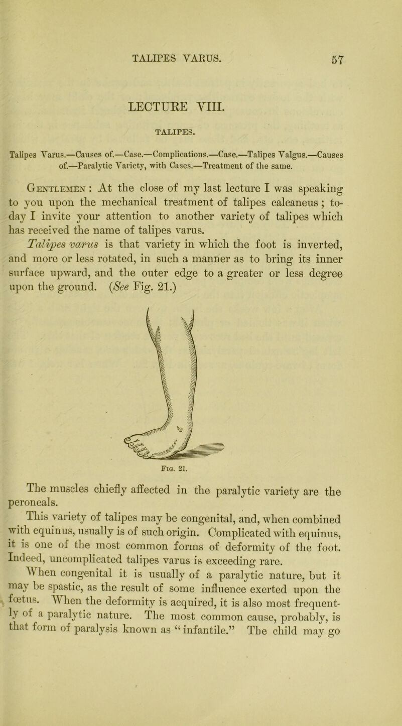 LECTUEE Yin. TALIPES. Talipes Varus.—Causes of.—Case.—Complications.—Case.—Talipes Valgus.—Causes of.—Paralytic Variety, with Cases.—Treatment of the same. Gentlemen : At tlie close of my last lecture I was speaking to you upon tlie mechanical treatment of talipes calcaneus ; to- day I invite your attention to another variety of talipes which has received the name of talipes varus. Talipes varus is that variety in which the foot is inverted, and more or less rotated, in such a manner as to bring its inner surface upward, and the outer edge to a greater or less degree upon the ground. (See Fig. 21.) The muscles chiefly affected in the paralytic variety are the peroneals. This variety of talipes may be congenital, and, when combined v ith equinus, usually is of such origin. Complicated with equinus, it is one of the most common forms of deformity of the foot. Indeed, uncomplicated talipes varus is exceeding rare. A\ hen congenital it is usually of a paralytic nature, but it may he spastic, as the result of some influence exerted upon the foetus. When the deformity is acquired, it is also most frequent- ly of a paralytic nature. The most common cause, probably, is that form oi paralysis known as u infantile.” The child may go