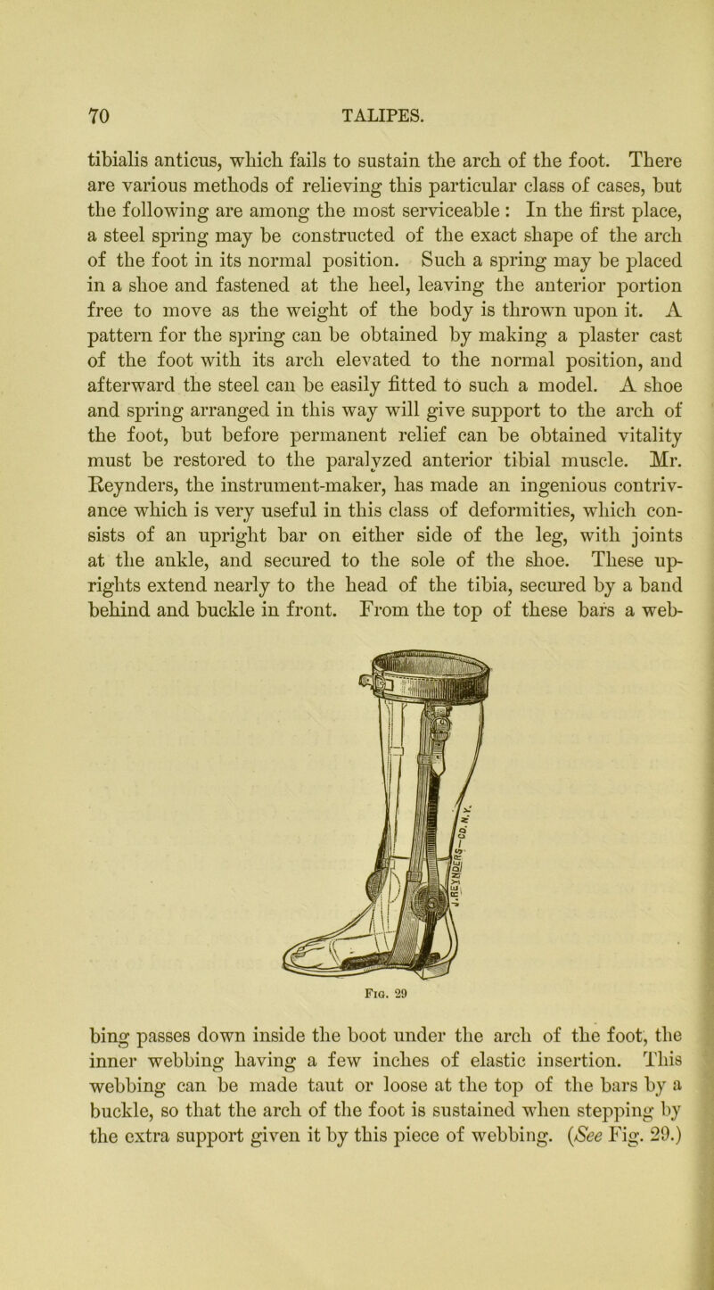 tibialis anticus, which fails to sustain the arch of the foot. There are various methods of relieving this particular class of cases, but the following are among the most serviceable : In the first place, a steel spring may be constructed of the exact shape of the arch of the foot in its normal position. Such a spring may be placed in a shoe and fastened at the heel, leaving the anterior portion free to move as the weight of the body is thrown upon it. A pattern for the spring can be obtained by making a plaster cast of the foot with its arch elevated to the normal position, and afterward the steel can be easily fitted to such a model. A shoe and spring arranged in this way will give support to the arch of the foot, but before permanent relief can be obtained vitality must be restored to the paralyzed anterior tibial muscle. Mr. Reynders, the instrument-maker, has made an ingenious contriv- ance which is very useful in this class of deformities, which con- sists of an upright bar on either side of the leg, with joints at the ankle, and secured to the sole of the shoe. These up- rights extend nearly to the head of the tibia, secured by a band behind and buckle in front. From the top of these bars a web- Fig. 29 bing passes down inside the boot under the arch of the foot, the inner webbing having a few inches of elastic insertion. This webbing can be made taut or loose at the top of the bars by a buckle, so that the arch of the foot is sustained when stepping by the extra support given it by this piece of webbing. (See Fig. 29.)