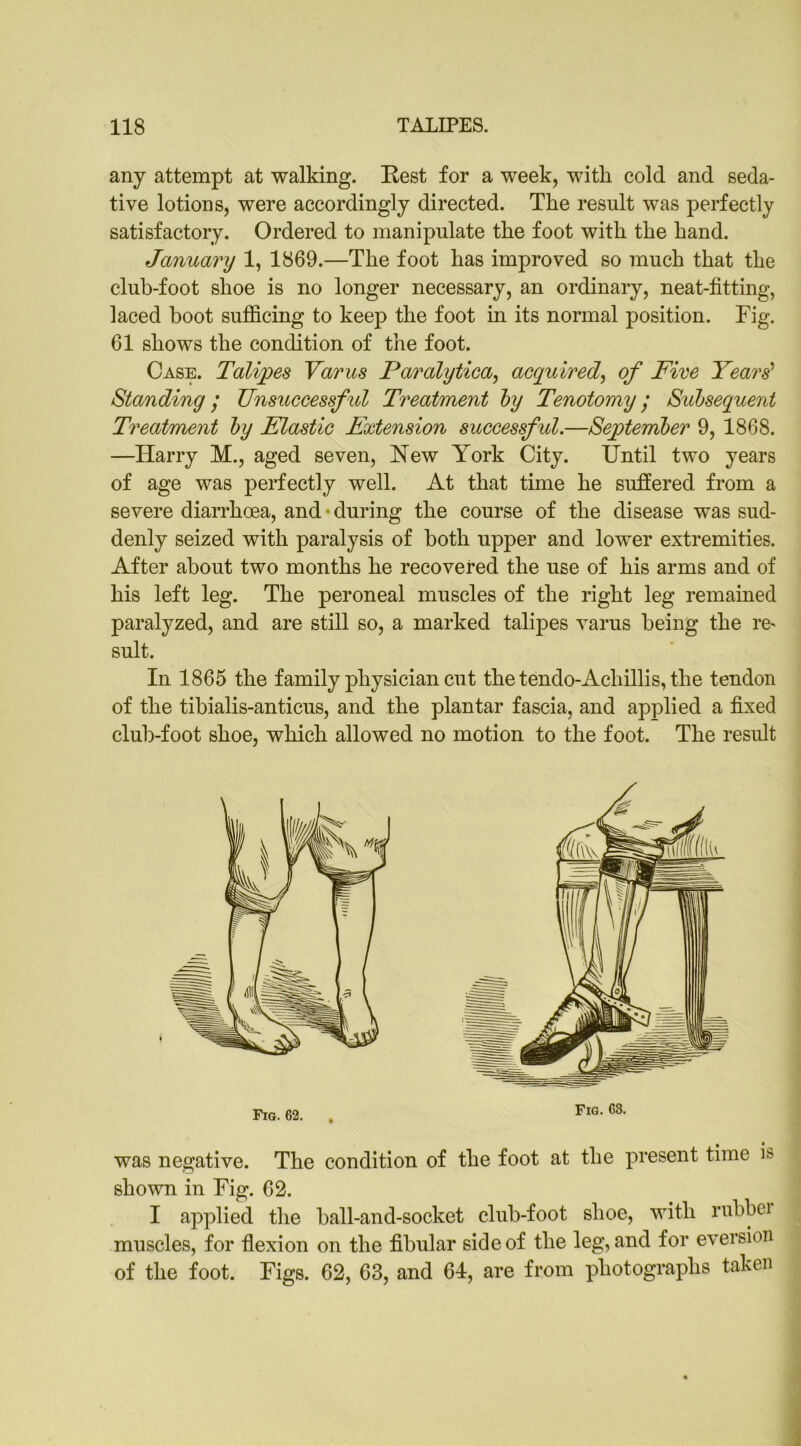 any attempt at walking. Rest for a week, with cold and seda- tive lotions, were accordingly directed. The result was perfectly satisfactory. Ordered to manipulate the foot with the hand. January 1, 1869.—The foot has improved so much that the club-foot shoe is no longer necessary, an ordinary, neat-fitting, laced boot sufficing to keep the foot in its normal position. Fig. 61 shows the condition of the foot. Case. Talipes Varus Paralytica, acquired, of Five Years'1 Standing/ Unsuccessful Treatment by Tenotomy; Subsequent Treatment by Elastic Extension successful.—September 9, 1868. —Harry M., aged seven, Hew York City. Until two years of age was perfectly well. At that time he suffered from a severe diarrhoea, and • during the course of the disease was sud- denly seized with paralysis of both upper and lower extremities. After about two months he recovered the use of his arms and of his left leg. The peroneal muscles of the right leg remained paralyzed, and are still so, a marked talipes varus being the re' suit. In 1865 the family physician cut the tendo-Achillis, the tendon of the tibialis-anticus, and the plantar fascia, and applied a fixed club-foot shoe, which allowed no motion to the foot. The result was negative. The condition of the foot at the present time is shown in Fig. 62. I applied the ball-and-socket club-foot shoe, with rubber muscles, for flexion on the fibular side of the leg, and for eversion of the foot. Figs. 62, 63, and 64, are from photographs taken