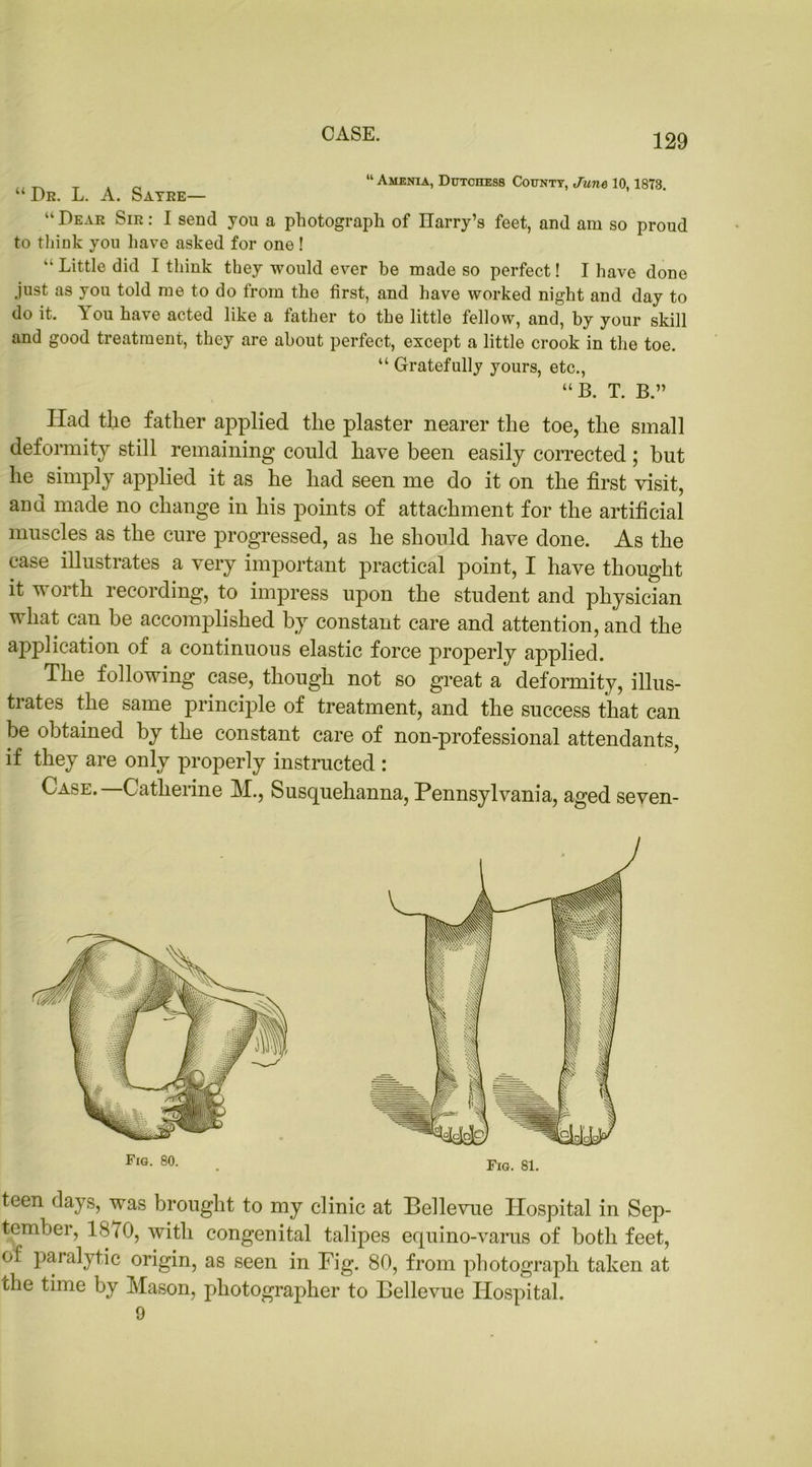 “ Amenia, Dutchess County, June 10,1873. “ Dr. L. A. Sayre— “ Dear Sir : I send you a photograph of IlaiTy’s feet, and am so proud to think you have asked for one ! “Little did I think they would ever he made so perfect! I have done just as you told me to do from the first, and have worked night and day to do it. You have acted like a father to the little fellow, and, by your skill and good treatment, they are about perfect, except a little crook in the toe. “ Gratefully yours, etc., “B. T. B.” Had the father applied the plaster nearer the toe, the small deformity still remaining could have been easily corrected; but he simply applied it as he had seen me do it on the first visit, aud made no change in his points of attachment for the artificial muscles as the cure progressed, as he should have done. As the case illustrates a very important practical point, I have thought it worth recording, to impress upon the student and physician what can be accomplished by constant care and attention, and the application of a continuous elastic force properly applied. The following case, though not so great a deformity, illus- trates the same principle of treatment, and the success that can be obtained by the constant care of non-professional attendants, if they are only properly instructed : Case. Catherine M., Susquehanna, Pennsylvania, aged seven- teen days, was brought to my clinic at Bellevue Hospital in Sep- tember, 1870, with congenital talipes equino-varus of both feet, of paralytic origin, as seen in Fig. 80, from photograph taken at che time by Mason, photographer to Bellevue Hospital. 9