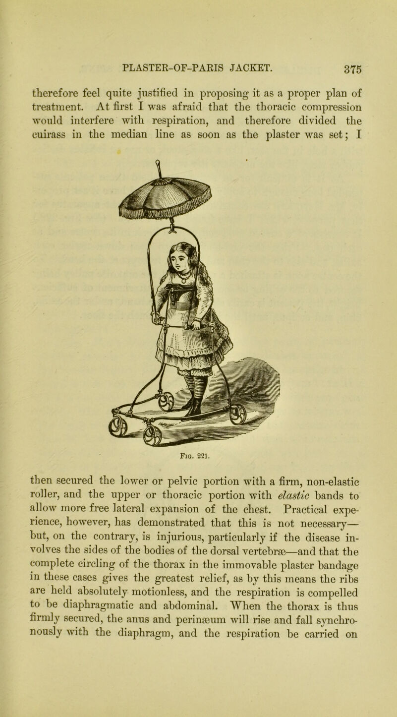 therefore feel quite justified in proposing it as a proper plan of treatment. At first I was afraid that the thoracic compression would interfere with respiration, and therefore divided the cuirass in the median line as soon as the plaster was set; I Fig. 221. then secured the lower or pelvic portion with a firm, non-elastic roller, and the upper or thoracic portion with elastic hands to allow more free lateral expansion of the chest. Practical expe- rience, however, has demonstrated that this is not necessary— hut, on the contrary, is injurious, particularly if the disease in- volves the sides of the bodies of the dorsal vertebrae—and that the complete circling of the thorax in the immovable plaster bandage in these cases gives the greatest relief, as by this means the ribs are held absolutely motionless, and the respiration is compelled to be diaphragmatic and abdominal. When the thorax is thus firmly secured, the anus and perinEeum will rise and fall synchro- nously with the diaphragm, and the respiration be carried on