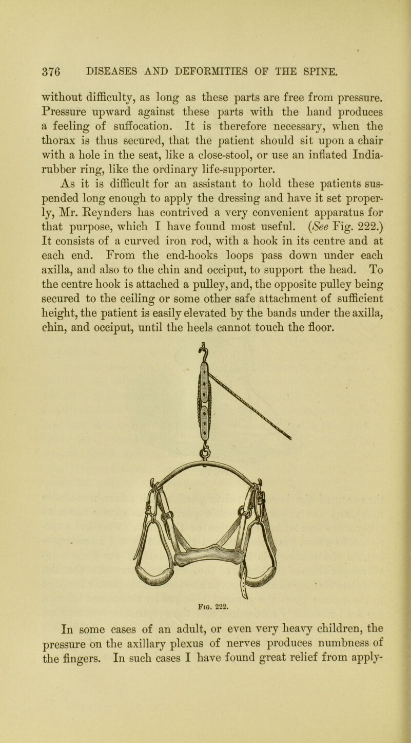 without difficulty, as long as these parts are free from pressure. Pressure upward against these parts with the hand produces a feeling of suffocation. It is therefore necessary, when the thorax is thus secured, that the patient should sit upon a chair with a hole in the seat, like a close-stool, or use an inflated India- rubber ring, like the ordinary life-supporter. As it is difficult for an assistant to hold these patients sus- pended long enough to apply the dressing and have it set proper- ly, Mr. Peynders has contrived a very convenient apparatus for that purpose, which I have found most useful. (See Fig. 222.) It consists of a curved iron rod, with a hook in its centre and at each end. From the end-hooks loops pass down under each axilla, and also to the chin and occiput, to support the head. To the centre hook is attached a pulley, and, the opposite pulley being secured to the ceiling or some other safe attachment of sufficient height, the patient is easily elevated by the bands under the axilla, chin, and occiput, until the heels cannot touch the floor. Fiq. 222. In some cases of an adult, or even very heavy children, the pressure on the axillary plexus of nerves produces numbness of the fingers. In such cases I have found great relief from apply-