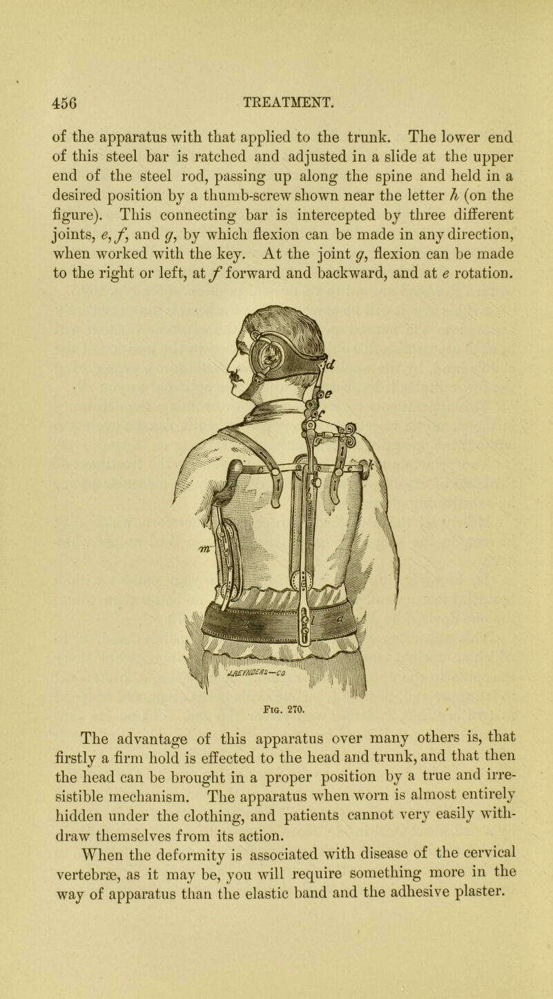 of the apparatus with that applied to the trunk. The lower end of this steel bar is ratched and adjusted in a slide at the upper end of the steel rod, passing up along the spine and held in a desired position by a thumb-screw shown near the letter h (on the figure). This connecting bar is intercepted by three different joints, £,/*, and y, by which flexion can be made in any direction, when worked with the key. At the joint g, flexion can be made to the right or left, at/’forward and backward, and at e rotation. Fig. 270. The advantage of this apparatus over many others is, that firstly a firm hold is effected to the head and trunk, and that then the head can be brought in a proper position by a true and irre- sistible mechanism. The apparatus when worn is almost entirely hidden under the clothing, and patients cannot very easily with- draw themselves from its action. When the deformity is associated with disease of the cervical vertebrae, as it may be, you will require something more in the way of apparatus than the elastic band and the adhesive plaster.