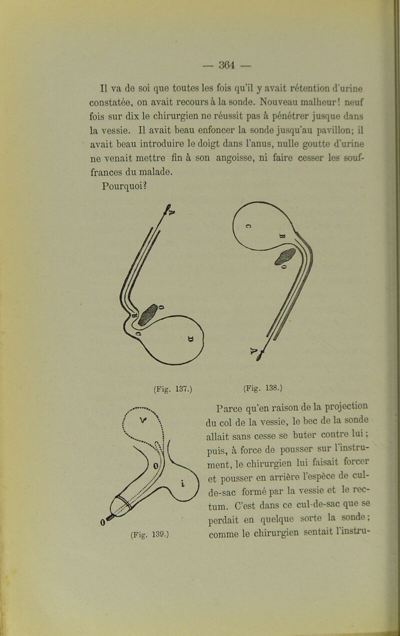 Il va de soi que toutes les fois qu’il y avait rétention d’urine constatée, on avait recours à la sonde. Nouveau malheur! neuf fois sur dix le chirurgien ne réussit pas à pénétrer jusque dans la vessie. Il avait beau enfoncer la sonde jusqu’au pavillon; il avait beau introduire le doigt dans l’anus, nulle goutte d’urine ne venait mettre fin à son angoisse, ni faire cesser les souf- frances du malade. Pourquoi? comme le chirurgien sentait l'instru- (Fig. 139.)