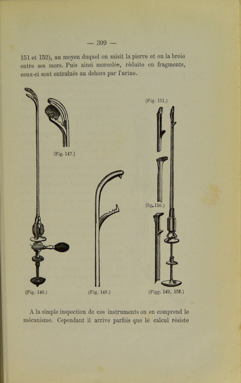 151 et 152), au moyen duquel on saisit la pierre et on la broie entre ses mors. Puis ainsi morcelée, réduite en fragments, ceux-ci sont entraînés au dehors par l’urine. (Fig. 147.) (Fig. 146.) (Fig. 151.) (fig. 150.) (Figg. 149, 152.) A la simple inspection de ces instruments on en comprend le mécanisme. Cependant il arrive parfois que le calcul résiste