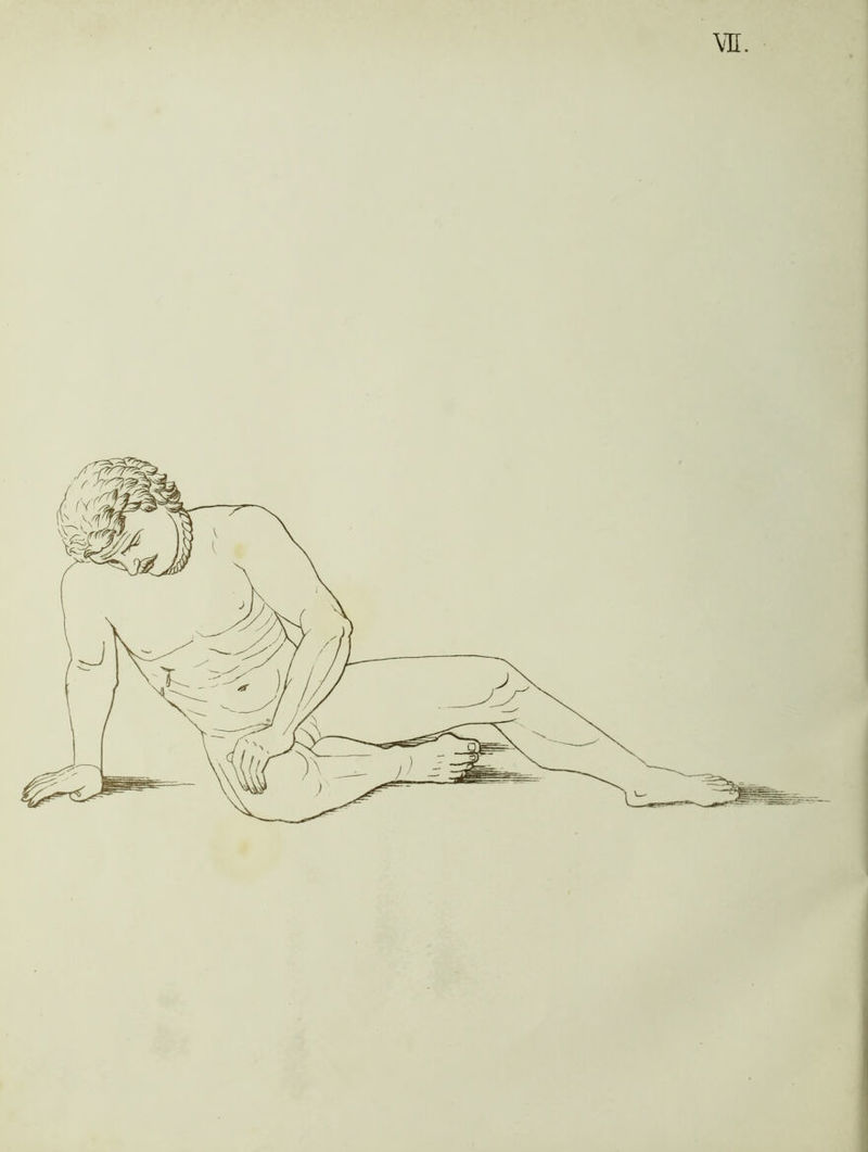 VE.