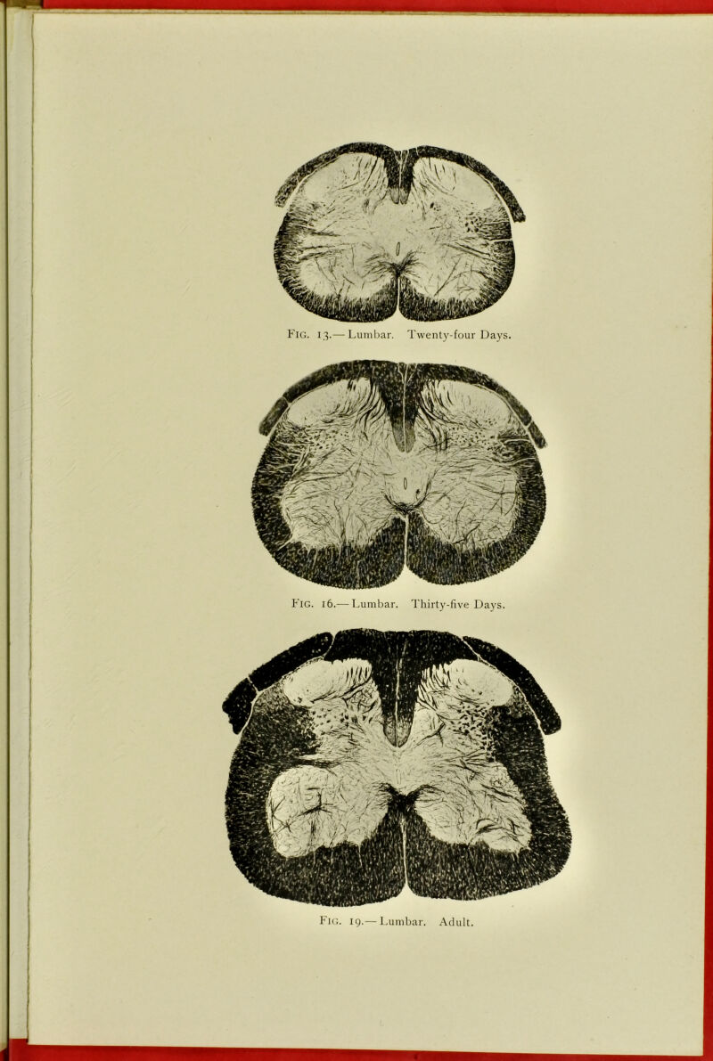 Fig. 13.— Lumbar. Twenty-four Days. P'lG. 16.— Lumbar. Thirty-five Days. Fig. 19.— Lumbar. Adult