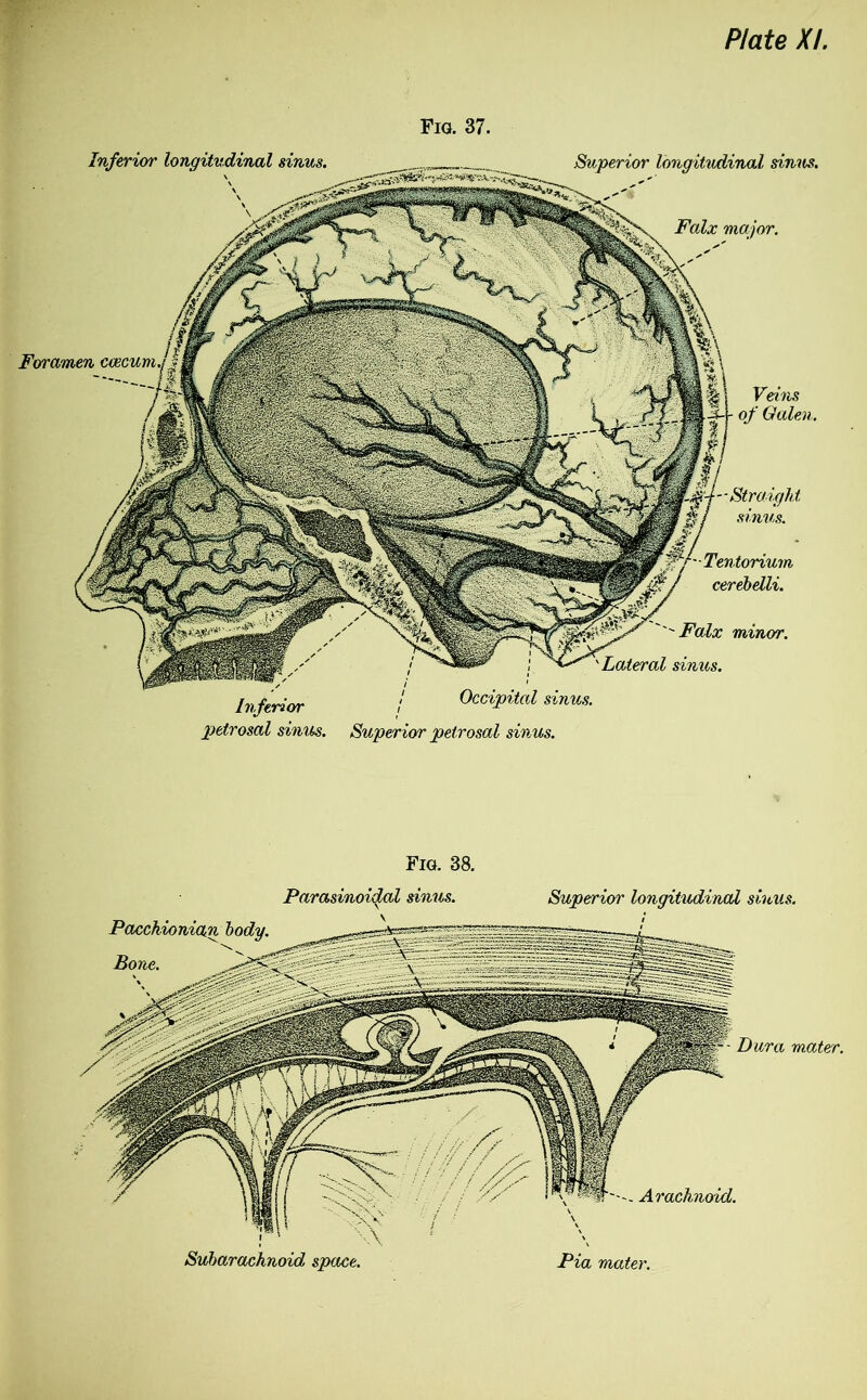 Fig. 37. Tentorium cerebdli. Falx minor. Lateral Inferior petrosal sinus. Occipital sinus. Superior petrosal sinus. Superior longitudinal sinus. Foramen Veins of Galen. Fig. 38. Parasinoidal sinus. Superior longitudinal sinus. Subarachnoid space. Pia mater. Dura mater. Arachnoid.