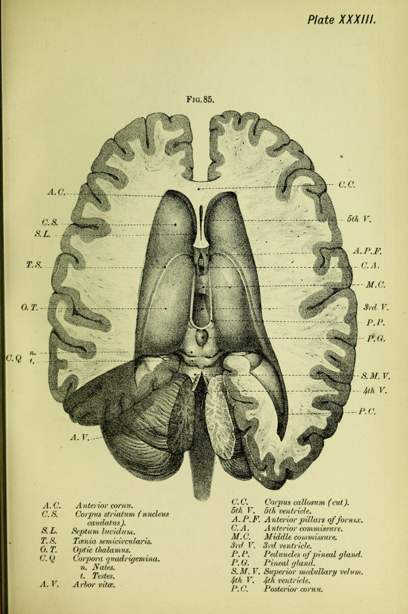 Fig. 85. O.T.- n. -- t. .... A.C. Anterior cornu. C. S. Corpus striatum (nucleus caudatus ). S. L. Septum lucidurn. T. S. Tcenia semicircularis. 0. T. Optic thalamus. C. Q Corpo'ra quadrigemina. n. Nates, t. Testes. A. V. Arbor vita. C. C. Corpus callosum (cut). 5th V. 5th ventricle. A. P.F. A nterior pillars of fornix. C.A. Anterior commissure. M. C. Middle commissure. 3rd V. 3rd ventricle. P. P. Peduncles of pineal gland. P. G. Pineal gland. S. M. V. Superior medullary velum. Jfth V. 4th ventricle. P. C. Posterior cornu. A.C.— T.S. „ A. V.. c.c. 5th V. P.F. C.A. M.C. 3rd V. P.P. P.G. S.M. V. - 4th V. --P.C.