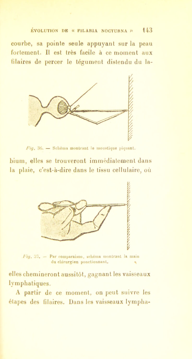 courbe, sa pointe seule appuyant sur la peau fortement. Il est très facile à ce moment aux lilaires de percer le tégument distendu du la- Fig, ~ Schéma monlrant le moustique piquant. bium, elles se trouveront immédiatement dans la plaie, c’est-à-dire dans le tissu cellulaire, où Fig, ’Si, — Par «^oinparaisoii, schéma monlratil la main <lu chirurçien ponctionnant. ^ elles chemineront aussitôt, gagnant les vaisseaux lymphatiques. A partir de ce moment, on peut suivre les étapes des lilaires. Dans les vaisseaux lympha-