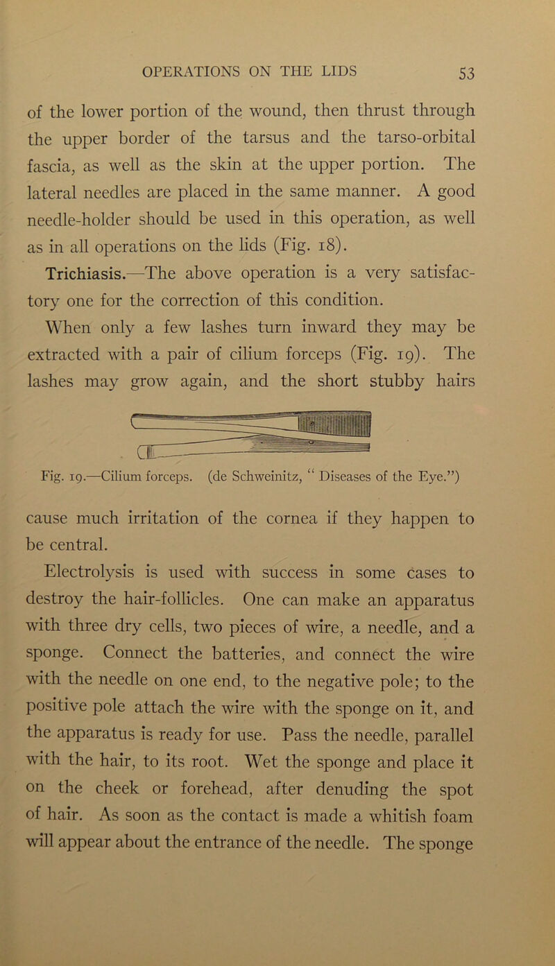 of the lower portion of the wound, then thrust through the upper border of the tarsus and the tarso-orbital fascia, as well as the skin at the upper portion. The lateral needles are placed in the same manner. A good needle-holder should be used in this operation, as well as in all operations on the lids (Fig. 18). Trichiasis.—The above operation is a very satisfac- tory one for the correction of this condition. When only a few lashes turn inward they may be extracted with a pair of cilium forceps (Fig. 19). The lashes may grow again, and the short stubby hairs Fig. 19.—Cilium forceps, (de Schweinitz, “ Diseases of the Eye.”) cause much irritation of the cornea if they happen to be central. Electrolysis is used with success in some cases to destroy the hair-follicles. One can make an apparatus with three dry cells, two pieces of wire, a needle, and a sponge. Connect the batteries, and connect the wire with the needle on one end, to the negative pole; to the positive pole attach the wire with the sponge on it, and the apparatus is ready for use. Pass the needle, parallel with the hair, to its root. Wet the sponge and place it on the cheek or forehead, after denuding the spot of hair. As soon as the contact is made a whitish foam will appear about the entrance of the needle. The sponge