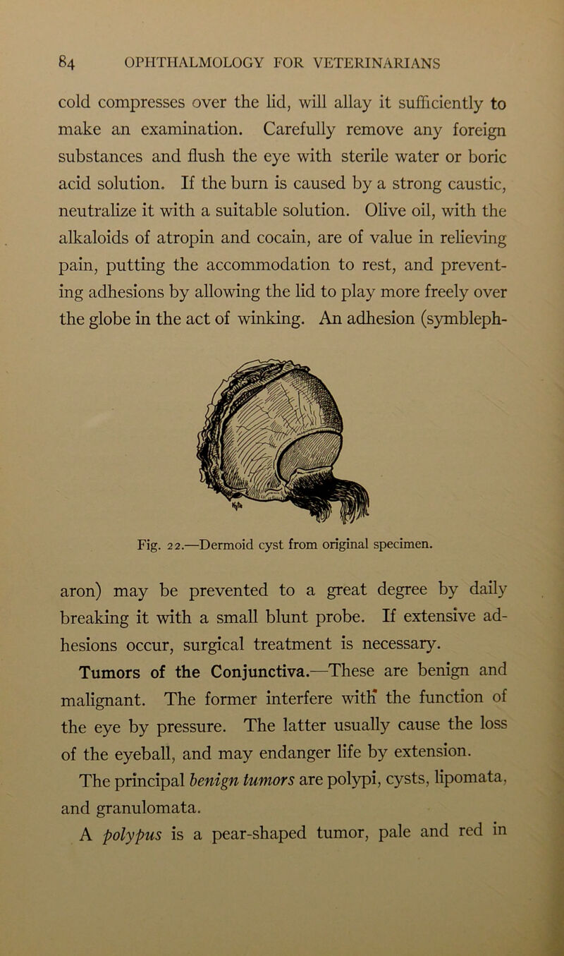 cold compresses over the lid, will allay it sufficiently to make an examination. Carefully remove any foreign substances and flush the eye with sterile water or boric acid solution. If the burn is caused by a strong caustic, neutralize it with a suitable solution. Olive oil, with the alkaloids of atropin and cocain, are of value in relieving pain, putting the accommodation to rest, and prevent- ing adhesions by allowing the lid to play more freely over the globe in the act of winking. An adhesion (symbleph- aron) may be prevented to a great degree by daily breaking it with a small blunt probe. If extensive ad- hesions occur, surgical treatment is necessary. Tumors of the Conjunctiva.—These are benign and malignant. The former interfere with* the function of the eye by pressure. The latter usually cause the loss of the eyeball, and may endanger life by extension. The principal benign tumors are polypi, cysts, lipomata, and granulomata. A polypus is a pear-shaped tumor, pale and red in Fig. 22.—Dermoid cyst from original specimen.