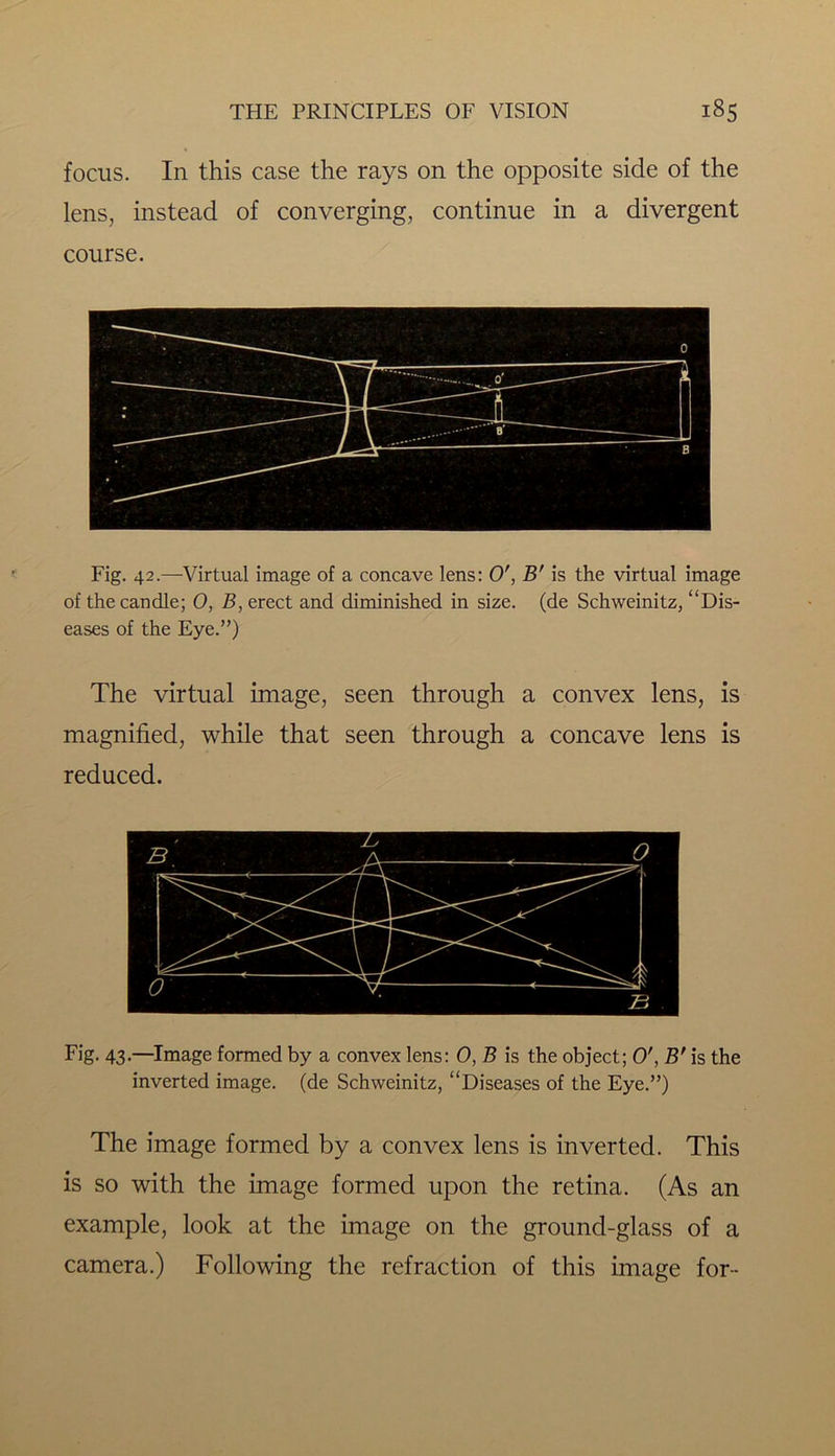 focus. In this case the rays on the opposite side of the lens, instead of converging, continue in a divergent course. Fig. 42.—Virtual image of a concave lens: O', B' is the virtual image of the candle; 0, B, erect and diminished in size, (de Schweinitz, “Dis- eases of the Eye.”) The virtual image, seen through a convex lens, is magnified, while that seen through a concave lens is reduced. Fig. 43.—Image formed by a convex lens: 0, B is the object; O', B' is the inverted image, (de Schweinitz, “Diseases of the Eye.”) The image formed by a convex lens is inverted. This is so with the image formed upon the retina. (As an example, look at the image on the ground-glass of a camera.) Following the refraction of this image for-