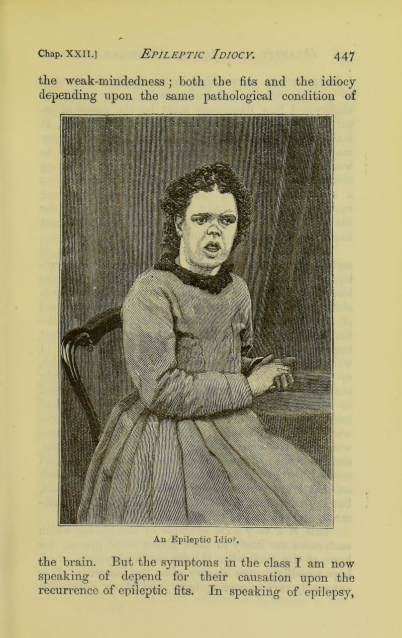 the weak-mindedness ; both the fits and the idiocy depending upon the same pathological condition of An Epileptic Iclioi-. the brain. But the symptoms in the class I am now speaking of depend for their causation upon the recurrence of epileptic fits. In speaking of epilepsy,