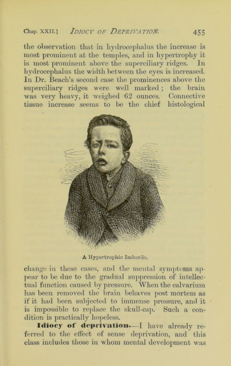 the observation that in hydrocephalus the increase is most prominent at the temples, and in hypertrophy it is most prominent above the superciliary ridges. In hydrocephalus the width between the eyes is increased. In Dr. Beach’s second case the prominences above the superciliary ridges were well marked; the brain was very heavy, it weighed 02 ounces. Connective tissue increase seems to be the chief histological A Hypertrophic Imbecile. change in these cases, and the mental symptoms ap- pear to be due to the gradual suppression of intellec- tual function caused by pressure. When the calvarium has been removed the brain behaves post mortem as if it had been subjected to immense pressure, and it is impossible to replace the skull-cap. Such a con- dition is practically hopeless. Idiocy of deprivation.—I have already re- ferred to the effect of sense deprivation, and this class includes those in whom mental development was
