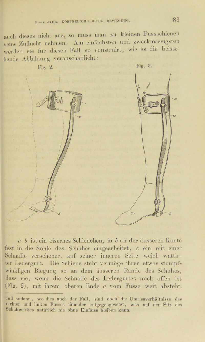 2. —7. JAHR. KÖUPKRUCHR SHITK. REWECiüNG. auch dieses nicht ans, so muss inan zu kleinen h ussscliienen seine Zuflucht neinneu. Am einfachsten und zweckinässigsten werden sie für diesen Fall so construirt, wie es die beiste- hende Abbildung veranschaulicht: Fig. 2. Fiff. 3. a h ist ein eisernes Schienchen, in h an der äusseren Kante fest in die Sohle des Schuhes cingearbeitet, c ein mit einer Schnalle versehener, auf seiner inneren Seite weich wattir- ter Ledergurt. Die Schiene steht vermöge ihrer etwas stumpf- winkligen Biegung so an dem äusseren Rande des Schuhes, dass sie, wenn die Schnalle des Ledergurtes noch offen ist (Fig. 2), mit ihrem oberen Ende a vom Fusse weit absteht. und sodann, wo dies auch der Fall, sind doch ' die Umrissverhältiiisse des rechten und linken Fusses einander entgegengesetzt, was auf den Sitz des Schuhwerkes natürlich nie ohne Einfluss bleiben kann.