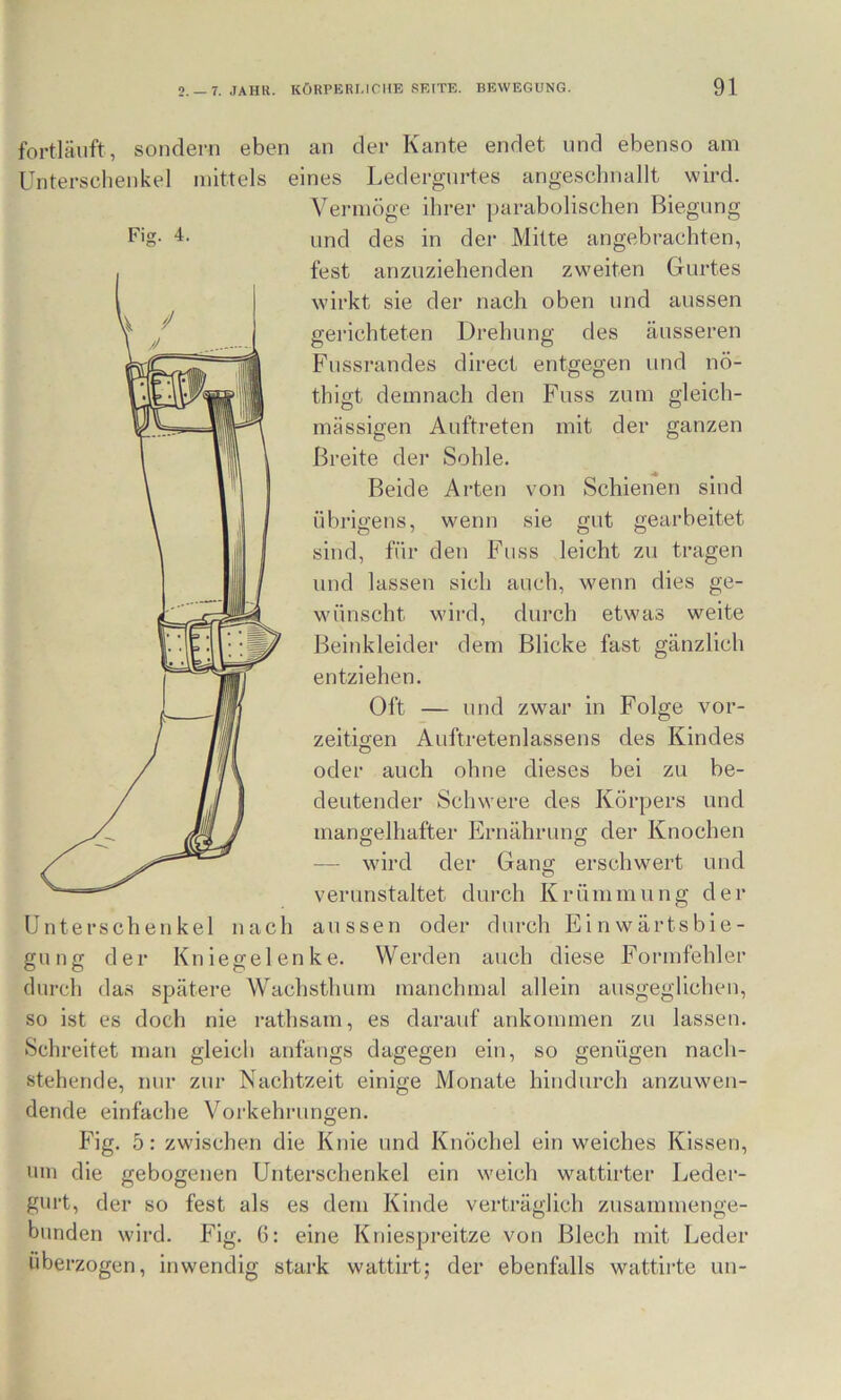Fis fortläuft, sondern eben an der Kante endet und ebenso am Unterschenkel mittels eines Ledergurtes angeschnallt wird. Vermöge ihrer parabolischen Biegung und des in der Mitte angebrachten, fest anzuziehenden zweiten Gurtes wirkt sie der nach oben und aussen gerichteten Drehung des äusseren Fussrandes direct entgegen und nö- thigt demnach den Fuss zum gleich- mässigen Auftreten mit der ganzen Breite der Sohle. Beide Arten von Schienen sind übrigens, wenn sie gut gearbeitet sind, für den Fuss leicht zu tragen und lassen sich auch, wenn dies ge- wünscht wird, durch etwas weite Beinkleider dem Blicke fast gänzlich entziehen. Oft — und zwar in Folge vor- zeitigen Auftretenlassens des Kindes oder auch ohne dieses bei zu be- deutender Schwere des Körpers und mangelhafter Ernährung der Knochen — wird der Gang erschwert und verunstaltet durch Krümmung der Unterschenkel nach aussen oder durch Einwärtsbie- gung der Kniegelenke. Werden auch diese Formfehler durch das spätere Wachsthum manchmal allein ausgeglichen, so ist es doch nie i-athsam, es darauf ankommen zu lassen. Schreitet man gleich anfangs dagegen ein, so genügen nach- stehende, nur zur Nachtzeit einige Monate hindurch anzuwen- dende einfache Vorkehrungen. Fig, 5: zwischen die Knie und Knöchel ein weiches Kissen, um die gebogenen Unterschenkel ein weich wattirter Leder- gurt, der so fest als es dem Kinde verträglich zusammenge- bunden wird. Fig. G: eine Kniespreitze von Blech mit Leder überzogen, inwendig stark wattirt; der ebenfalls wattirte un-