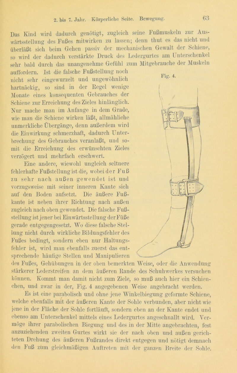 Das Kind wird dadurch genötigt, zugleich seine Fußmuskeln zur Aus- wärtsstellung des Fußes mitwirken zu lassen; denn thut es das nicht und überläßt sich beim Gehen passiv der mechanischen Gewalt der Schiene, so wird der dadurch verstärkte Druck des Ledergurtes am Unterschenkel sehr bald durch das unangenehme Gefühl zum Mitgebrauche der Muskeln auffordern. Ist die falsche Fußstellung noch nicht sehr eingewurzelt und ungewöhnlich hartnäckig, so sind in der Kegel wenige Monate eines konsequenten Gebrauches der Schiene zur Erreichung des Zieles hinlänglich. Nur mache man im Anfänge in dem Grade, wie man die Schiene wirken läßt, allmähliche unmerkliche Übergänge, denn außerdem wird die Einwirkung schmerzhaft, dadurch Unter- brechung des Gebrauches veranlaßt, und so- mit die Erreichung des erwünschten Zieles verzögert und mehrfach erschwert. Eine andere, wiewohl ungleich seltnere fehlerhafte Fußstellung ist die, wobei der Fuß zu sehr nach außen gewendet ist und vorzugsweise mit seiner inneren Kante sich auf den Boden aufsetzt. Die äußere Fuß- kante ist neben ihrer Richtung nach außen zugleich nach oben gewendet. Die falsche Fuß- stellung ist jener bei Einwärtsstellung derFüße gerade entgegengesetzt. Wo diese falsche Stel- lung nicht durch wirkliche Bildungsfehler des Fußes bedingt, sondern eben nur Haltungs- fehler ist, wird man ebenfalls zuerst das ent- sprechende häufige Stellen und Manipulieren des Fußes, Gehübungen in der oben bemerkten Weise, oder die Anwendung stärkerer Lederstreifen an dem äußeren Rande des Schuh Werkes versuchen können. Kommt man damit nicht zum Ziele, so muß auch hier ein Schien- chen, und zwar in der, Fig. 4 angegebenen Weise angebracht werden. Es ist eine parabolisch und ohne jene Winkelbiegung geformte Schiene, welche ebenfalls mit der äußeren Kante der Sohle verbunden, aber nicht wie jene in der Fläche der Sohle fortläuft, sondern eben an der Kante endet und ebenso am Unterschenkel mittels eines Ledergurtes angeschnallt wird. Ver- möge ihrer parabolischen Biegung und des in der Mitte angebrachten, fest anzuziehenden zweiten Gurtes wirkt sie der nach oben und außen gerich- teten Drehung des äußeren Fußrandes direkt entgegen und nötigt demnach den Fuß zum gleichmäßigen Auftreten mit der ganzen Breite der Sohle.
