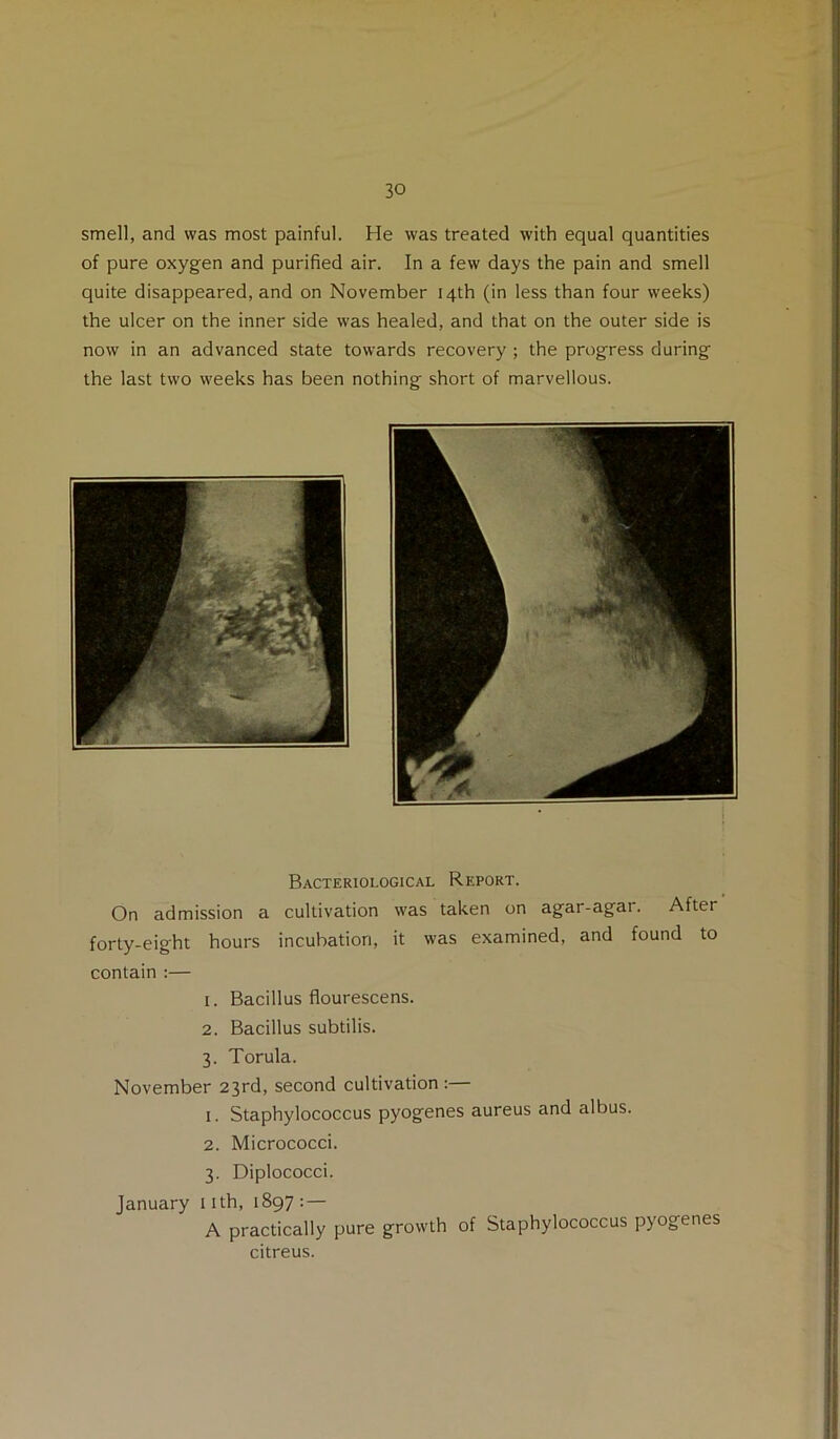 smell, and was most painful. He was treated with equal quantities of pure oxygen and purified air. In a few days the pain and smell quite disappeared, and on November 14th (in less than four weeks) the ulcer on the inner side was healed, and that on the outer side is now in an advanced state towards recovery ; the progress during the last two weeks has been nothing short of marvellous. Bacteriological Report. On admission a cultivation was taken on agar-agar. After forty-eight hours incubation, it was examined, and found to contain :— 1. Bacillus flourescens. 2. Bacillus subtilis. 3. Torula. November 23rd, second cultivation :— 1. Staphylococcus pyogenes aureus and albus. 2. Micrococci. 3. Diplococci. January nth, 1897: — A practically pure growth of Staphylococcus pyogenes citreus.