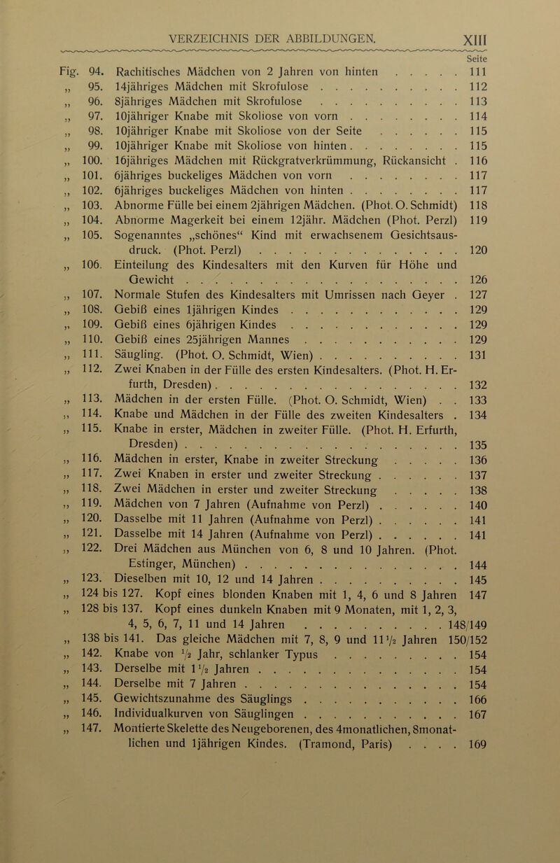 Seite Fig. 94. Rachitisches Mädchen von 2 Jahren von hinten 111 „ 95. 14jähriges Mädchen mit Skrofulöse 112 „ 96. Sjähriges Mädchen mit Skrofulöse 113 „ 97. lOjähriger Knabe mit Skoliose von vorn 114 „ 98. lOjähriger Knabe mit Skoliose von der Seite 115 „ 99. lOjähriger Knabe mit Skoliose von hinten 115 „ 100. löjähriges Mädchen mit Rückgratverkrümmung, Rückansicht . 116 „ 101. öjähriges buckeliges Mädchen von vorn 117 ,, 102. 6jähriges buckeliges Mädchen von hinten 117 ,, 103. Abnorme Fülle bei einem 2jährigen Mädchen. (Phot. O. Schmidt) 118 ,, 104. Abnorme Magerkeit bei einem 12jähr. Mädchen (Phot. Perzl) 119 „ 105. Sogenanntes „schönes“ Kind mit erwachsenem Gesichtsaus- druck. (Phot. Perzl) 120 „ 106. Einteilung des Kindesalters mit den Kurven für Höhe und Gewicht 126 ,, 107. Normale Stufen des Kindesalters mit Umrissen nach Geyer . 127 „ 108. Gebiß eines 1jährigen Kindes 129 „ 109. Gebiß eines 6jährigen Kindes 129 „ 110. Gebiß eines 25jährigen Mannes 129 „ 111. Säugling. (Phot. O. Schmidt, Wien) 131 „ 112. Zwei Knaben in der Fülle des ersten Kindesalters. (Phot. H. Er- furth, Dresden) 132 „ 113. Mädchen in der ersten Fülle. (Phot. O. Schmidt, Wien) . . 133 ,, 114. Knabe und Mädchen in der Fülle des zweiten Kindesalters . 134 „ 115. Knabe in erster, Mädchen in zweiter Fülle. (Phot. H. Erfurth, Dresden) 135 ,, 116. Mädchen in erster, Knabe in zweiter Streckung 136 „ 117. Zwei Knaben in erster und zweiter Streckung 137 „ 118. Zwei Mädchen in erster und zweiter Streckung 138 ,, 119. Mädchen von 7 Jahren (Aufnahme von Perzl) 140 „ 120. Dasselbe mit 11 Jahren (Aufnahme von Perzl) 141 „ 121. Dasselbe mit 14 Jahren (Aufnahme von Perzl) 141 ,, 122. Drei Mädchen aus München von 6, 8 und 10 Jahren. (Phot. Estinger, München) 144 „ 123. Dieselben mit 10, 12 und 14 Jahren 145 „ 124 bis 127. Kopf eines blonden Knaben mit 1, 4, 6 und 8 Jahren 147 „ 128 bis 137. Kopf eines dunkeln Knaben mit 9 Monaten, mit 1, 2, 3, 4, 5, 6, 7, 11 und 14 Jahren 148/149 „ 138 bis 141. Das gleiche Mädchen mit 7, 8, 9 und lU/a Jahren 150/152 „ 142. Knabe von 72 Jabr, schlanker Typus 154 „ 143. Derselbe mit U/2 Jahren 154 „ 144. Derselbe mit 7 Jahren 154 „ 145. Gewichtszunahme des Säuglings 166 „ 146. Individualkurven von Säuglingen 167 „ 147. Montierte Skelette des Neugeborenen, des 4monatlichen, 8monat- lichen und 1jährigen Kindes. (Tramond, Paris) .... 169