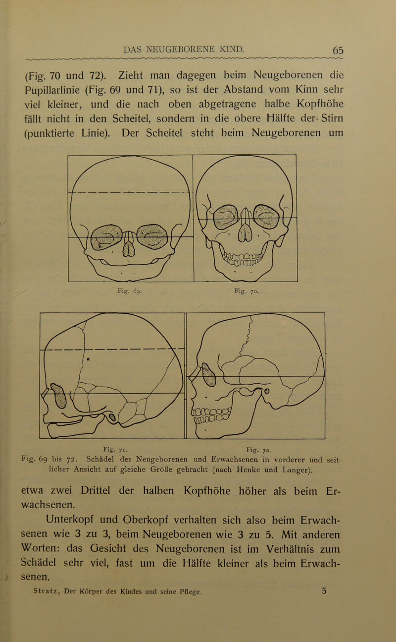 (Fig. 70 und 72). Zieht man dagegen beim Neugeborenen die Pupillarlinie (Fig. 69 und 71), so ist der Abstand vom Kinn sehr viel kleiner, und die nach oben abgetragene halbe Kopfhöhe fällt nicht in den Scheitel, sondern in die obere Flälfte der* Stirn (punktierte Linie). Der Scheitel steht beim Neugeborenen um Fig. 69 bis 72. Schädel des Neugeborenen und Erwachsenen in vorderer und seit- licher Ansicht auf gleiche Größe gebracht (nach Henke und Langer). etwa zwei Drittel der halben Kopfhöhe höher als beim Er- wachsenen. ünterkopf und Oberkopf verhalten sich also beim Erwach- senen wie 3 zu 3, beim Neugeborenen wie 3 zu 5. Mit anderen Worten: das Gesicht des Neugeborenen ist im Verhältnis zum Schädel sehr viel, fast um die Hälfte kleiner als beim Erwach- senen. Stratz, Der Körper des Kindes und seine Pflege. 5