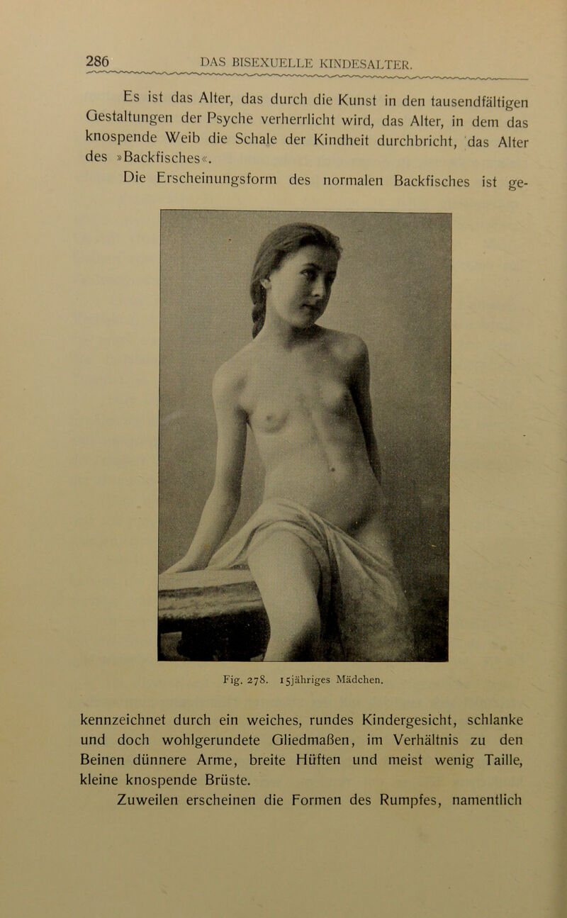 Es ist das Alter, das durch die Kunst in den tausendfältigen Gestaltungen der Psyche verherrlicht wird, das Alter, in dem das knospende Weib die Schale der Kindheit durchbricht, das Alter des »Backfisches«. Die Erscheinungsform des normalen Backfisches ist ge- Fig, 278. I5jähriges Mädchen. kennzeichnet durch ein weiches, rundes Kindergesicht, schlanke und doch wohlgerundete Gliedmaßen, im Verhältnis zu den Beinen dünnere Arme, breite Hüften und meist wenig Taille, kleine knospende Brüste. Zuweilen erscheinen die Formen des Rumpfes, namentlich