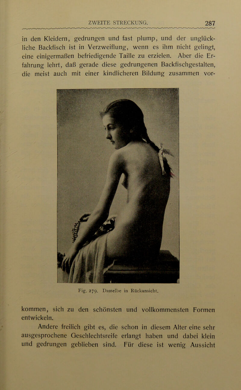 in den Kleidern, gedrungen und fast plump, und der unglück- liche Backfisch ist in Verzweiflung, wenn es ihm nicht gelingt, eine einigermaßen befriedigende Taille zu erzielen. Aber die Er- fahrung lehrt, daß gerade diese gedrungenen Backfischgestalten, die meist auch mit einer kindlicheren Bildung zusammen vor- Fig. 279. Dasselbe in Rückansicht. kommen, sich zu den schönsten und vollkommensten Formen entwickeln. Andere freilich gibt es, die schon in diesem Alter eine sehr ausgesprochene Geschlechtsreife erlangt haben und dabei klein und gedrungen geblieben sind. Für diese ist wenig Aussicht
