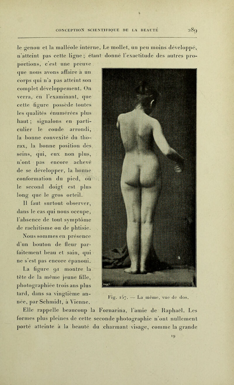 le genou et la malléole interne. Le mollet, un peu moins développé, n’atteint pas cette ligne; étant donné l’exactitude des autres pro- portions, c’est une preuve que nous avons affaire à un corps qui n’a pas atteint son complet développement. On verra, en l’examinant, que cette figure possède toutes les qualités énumérées plus haut ; signalons en parti- culier le coude arrondi, la bonne convexité du tho- rax, la bonne position des seins, qui, eux non plus, n’ont pas encore achevé de se développer, la bonne conformation du pied, où le second doigt est plus long que le gros orteil. Il faut surtout observer, dans le cas qui nous occupe, l’absence de tout symptôme de rachitisme ou de phtisie. Nous sommes en présence d’un bouton de Heur par- faitement beau et sain, qui ne s'est pas encore épanoui. La figure 91 montre la tète de la même jeune fille, photographiée trois ans plus tard, dans sa vingtième an- née, par Schmidt, à Vienne. Elle rappelle beaucoup la Fornarina, l’amie de Raphaël. Les fo nues plus pleines de cette seconde photographie 11’ont nullement porté atteinte a la beauté du charmant visage, comme la grande Fig. ijy. — La môme, vue de dos. ‘9