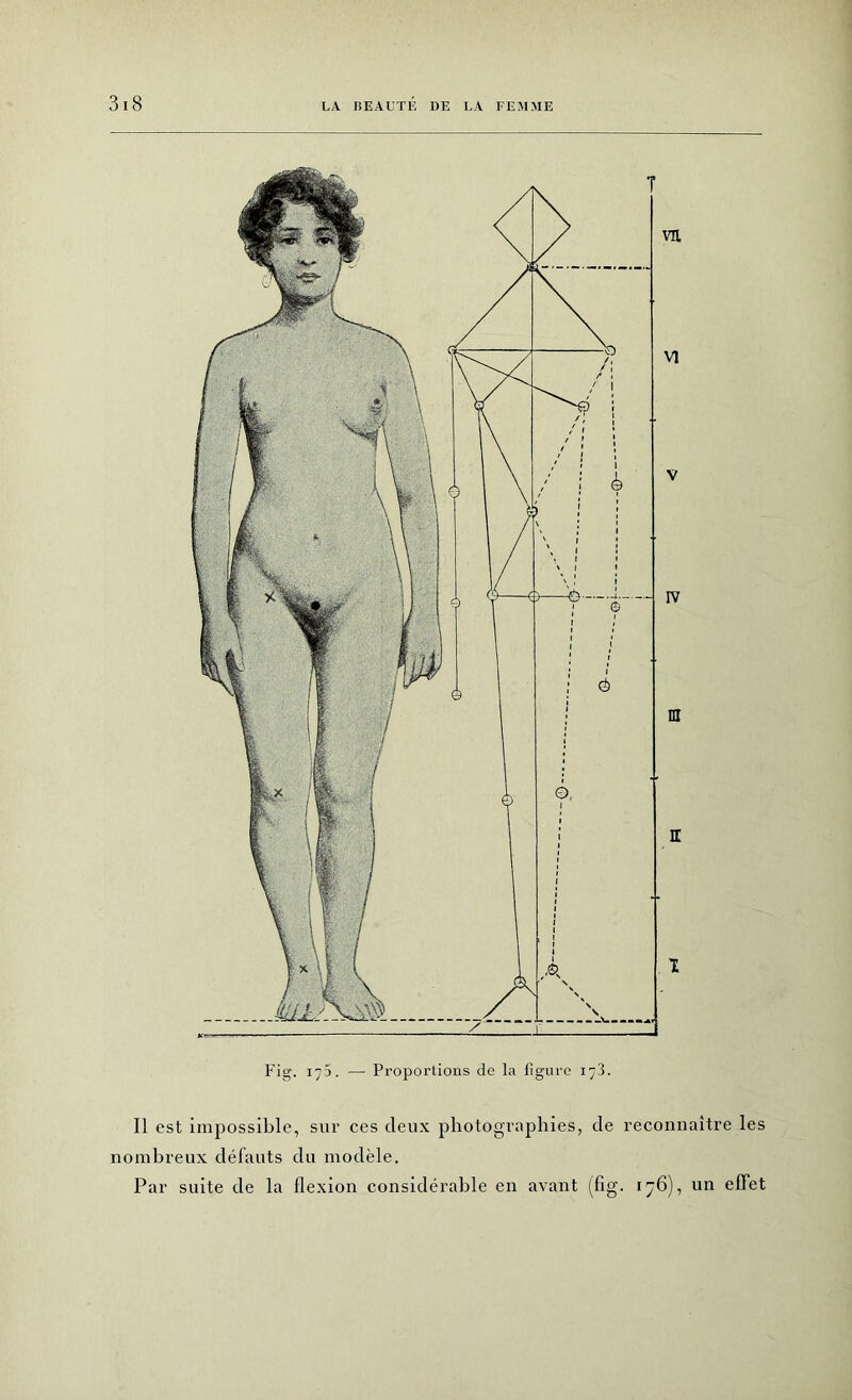 Il est impossible, sur ces deux photographies, de reconnaître les nombreux défauts du modèle. Par suite de la llexion considérable en avant (fig. 176), un effet