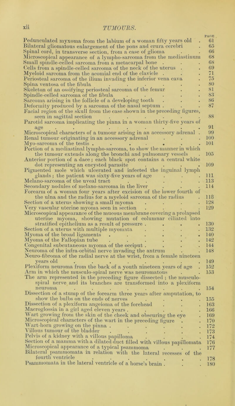 PAOE Pedunculated myxoma from the labium of a woman fifty years old . 61 Bilateral gliomatous enlargement of the pons and crura cerebri . 65 Spinal cord, in transverse section, from a case of glioma . . 66 Microscopical appearance of a lympho-sarcoma from the mediastinum 68 Small spindle-celled sarcoma from a metacarpal bone . . .68 Cells from a spindle-celled sarcoma of the neck of the uterus . . 69 Myeloid sarcoma from the acomial end of the clavicle . . .71 Periosteal sarcoma of the ilium invading the inferior vena cava . 75 Spina ventosa of the fibula . . . . . .80 Skeleton of an ossifying periosteal sarcoma of the femur . .81 Spindle-celled sarcoma of the fibula . . . . .S3 Sarcoma arising in the follicle of a developing tooth . . .86 Deformity produced by a sarcoma of the nasal septum . . .87 Facial region of the skull from the case shown in the preceding figures, seen in sagittal section . . . . . .88 Parotid sarcoma implicating the pinna in a woman thirty-five years of age . ...... 91 Microscopical characters of a tumour arising in an accessory adrenal . 99 Kenal tumour originating in an accessory adrenal . . .100 Myo-sarcoma of the testis . . ..... 101 Portion of a mediastinal lympho-sarcoma, to show the manner in which the tumour extends along the bronchi and pulmonary vessels . 105 Anterior portion of a dace; each black spot contains a central white dot representing an encysted parasite .... 109 Pigmented mole which ulcerated and infected the inguinal lymph glands; the patient was sixty-five years of age . . .111 Melano-sarcoma of the uveal tract ..... 113 Secondary nodules of melano-sarcoma in the liver . . .114 Forearm of a woman four years after excision of the lower fourth of the ulna and the radius for a myeloid sarcoma of the radius . 118 Section of a uterus showing a small myoma .... 128 Very vascular uterine myoma seen in section . . . .129 Microscopical appearance of the mucous membrane covering a prolapsed uterine myoma, showing mutation of columnar ciliated into stratified epithelium as a result of pressure . . . .130 Section of a uterus with multiple myomata .... 132 Myoma of the broad ligaments . . . . . .140 Myoma of the Fallopian tube ...... 142 Congenital subcutaneous myoma of the occiput .... 144 Neuroma of the infra-orbital nerve invading the antrum . . 148 Neuro-fibroma of the radial nerve at the wrist, from a female nineteen years old ........ 149 Plexiform neuroma from the back of a youth nineteen yeai’s of age . 152 Arm in which the musculo-spiral nerve was neuromatous . . 153 The arm represented in the preceding figure dissected ; the musculo- spiral nerve and its branches are transformed into a plexiform neuroma . . . . . . . .154 Dissection of a stump of the forearm three years after amputation, to show the bulbs on the ends of nerves .... 155 Dissection of a plexiform angeioma of the forehead . . .163 Macroglossia in a girl aged eleven years ..... 166 Wart growing from the skin of the cheek and obscuring the eye . 169 Microscopical characters of the wart in the preceding figure . .170 Wart-horn growing on the pinna . . . . . .172 Villous tumour of the bladder . . . . . .173 Pelvis of a kidney with a villous papilloma .... 174 Section of a mamma with a dilated duct filled with villous papillomata 176 Microscopical appearance of a typical psammoma . . .177 Bilateral psammomata in relation with the lateral recesses of the fourth ventricle . . . . t < .178 Psammomata in the lateral ventricle of a horse’s brain . . . 180