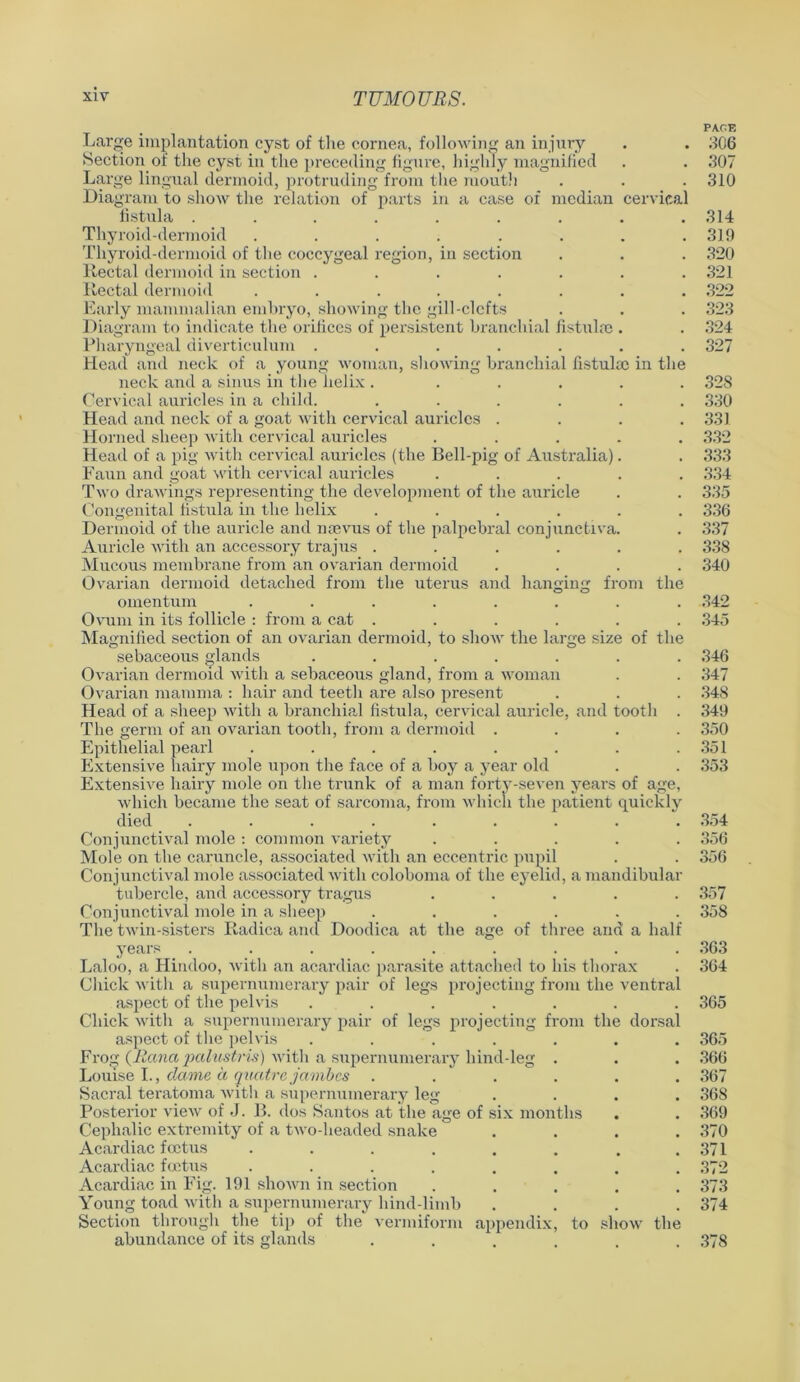 PAGE Large implantation cyst of the cornea, following an injury . . 306 Section of the cyst in the preceding figure, highly magnified . . 307 Large lingual dermoid, protruding from the mouth . . . 310 Diagram to show the relation of parts in a case of median cervical fistula ......... 314 Thyroid-dermoid ........ 319 Thyroid-dermoid of the coccygeal region, in section . . . 320 Rectal dermoid in section ....... 321 Rectal dermoid ........ 322 Early mammalian embryo, showing the gill-clcfts . . . 323 Diagram to indicate the orifices of persistent branchial fistula?. . 324 Pharyngeal diverticulum ....... 327 Head and neck of a young woman, showing branchial fistula? in the neck and a sinus in the helix . ..... 328 Cervical auricles in a child. ...... 330 Head and neck of a goat with cervical auricles .... 331 Horned sheep with cervical auricles ..... 332 Head of a pig with cervical auricles (the Bell-pig of Australia). . 333 Faun and goat with cervical auricles ..... 334 Two drawings representing the development of the auricle . . 335 Congenital fistula in the helix ...... 336 Dermoid of the auricle and noevus of the palpebi'al conjunctiva. . 337 Auricle with an accessory trajus ...... 338 Mucous membrane from an ovarian dermoid .... 340 Ovarian dermoid detached from the uterus and hanging from the omentum ........ 342 Ovum in its follicle : from a cat ...... 345 Magnified section of an ovarian dermoid, to show the large size of the sebaceous glands ....... 346 Ovarian dermoid with a sebaceous gland, from a woman . . 347 Ovarian mamma : hair and teeth are also present . . . 348 Head of a sheep with a branchial fistula, cervical auricle, and tooth . 349 The germ of an ovarian tooth, from a dermoid .... 350 Epithelial pearl . . . . . . . .351 Extensive hairy mole upon the face of a boy a year old . . 353 Extensive hairy mole on the trunk of a man forty-seven years of age, which became the seat of sarcoma, from which the patient quickly died ......... 354 Conjunctival mole : common variety ..... 356 Mole on the caruncle, associated with an eccentric pupil . . 356 Conjunctival mole associated with coloboma of the eyelid, a mandibular tubercle, and accessory tragus ..... 357 Conjunctival mole in a sheep ...... 358 The twin-sisters Radica and Doodica at the age of three and a half years ......... 363 Laloo, a Hindoo, with an acardiac parasite attached to his thorax . 364 Chick with a supernumerary pair of legs projecting from the ventral aspect of the pelvis ....... 365 Chick with a supernumerary pair of legs projecting from the dorsal aspect of the pelvis ....... 365 Frog (liana pcilustris) with a supernumerary liind-leg . . . 366 Louise I., dame a quatre javibcs . . . . . 367 Sacral teratoma with a supernumerary leg .... 368 Posterior view of J. B. dos Santos at the age of six months . . 369 Cephalic extremity of a two-headed snake .... 370 Acardiac foetus . . . . . . . .371 Acardiac Fetus ........ 372 Acardiac in Fig. 191 shown in section ..... 373 Young toad with a supernumerary hind-limb .... 374 Section through the tip of the vermiform appendix, to show the abundance of its glands ...... 378