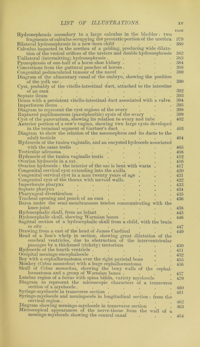 PAGE Hydronephrosis secondary to a large calculus in the bladder: two fragments of calculus occupying the prostatic portion of the urethra 379 Bilateral hydronephrosis in a new-born child .... 3S0 Calculus impacted in the urethra of a gelding, producing wide dilata- tion of the vesical orifices of the ureters and double hydronephrosis 382 Unilateral (intermitting) hydronephrosis ..... 383 Pyonephrosis of one-half of a horse-shoe kidney .... 384 Concretions from the guttural pouches of horses .... 388 Congenital pedunculated tumour of the navel .... 389 Diagram of the alimentary canal of the embryo, showing the position of the yolk sac ........ 390 Cyst, probably of the vitello-intestinal duct, attached to the intestine of an emu ........ 392 Septate ileum ........ 393 Ileum with a persistent vitello-intestinal duct associated with a valve. 394 Imperforate ileum ........ 395 Diagram to represent the cyst regions of the ovary . . . 398 Ruptured papillomatous (paroophoritic) cysts of the ovary . . 399 Cyst of the parovarium, showing its relation to ovary and tube . 402 Anterior portion of a cow’s vagina, showing two large cysts developed in the terminal segment of Gartner’s duct .... 403 Diagram to show the relation of the mesonephros and its ducts to the adult testicle ........ 404 Hydrocele of the tunica vaginalis, and an encysted hydrocele associated with the same testis ....... 405 Testicular adenoma ....... 408 Hydrocele of the tunica vaginalis testis . . . . .412 Ovarian hydrocele in a rat. ...... 416 Ovarian hydrocele : the interior of the sac is bent with warts . .417 Congenital cervical cyst extending into the axilla . . . 420 Congenital cervical cyst in a man twenty years of age . . .421 Congenital cyst of the thorax with neevoid walls. . . . 422 Imperforate pharynx ....... 433 Septate pharynx ........ 434 Pharyngeal diverticulum ....... 435 Tracheal opening and pouch of an emu . . , . . 436 Bursa under the semi-membranosus tendon communicating with the knee-joint ........ 438 Hydrocephalic skull, from an infant ..... 445 Hydrocephalic skull, showing Wormian bones .... 446 Sagittal section of a hydrocephalic skull from a child, with the brain in situ ......... 447 Drawing from a cast of the head of James Cardinal . . . 449 Head of a lion’s whelp in section, showing great dilatation of the cerebral ventricles, due to obstruction of the interventricular passages by a thickened (rickety) tentorium . . . 450 Hydrocele of the fourth ventricle . . . . . .451 Occipital meningo-encephalocele ...... 452 Boy with a cephallnematoma over the right parietal bone . . 455 Monkey (Cebus monachus) with a huge cephalhsematoma . . 456 Skull of Cebus monachus, showing the bony walls of the cephal- hematoma and a group of Wormian bones .... 457 Lumbar region of a foetus with spina bifida, variety myelocele . 459 Diagram to represent the microscopic characters of a transverse section of a myelocele ....... 460 Syringo-myelocele in transverse section . . . . .461 Syringo-myelocele and meningocele in longitudinal section : from the cervical region ........ 462 Diagram showing ineningo-myelocele in transverse section . . 463 Microscopical appearances of the nerve-tissue meningo-myelocele showing the central canal 464