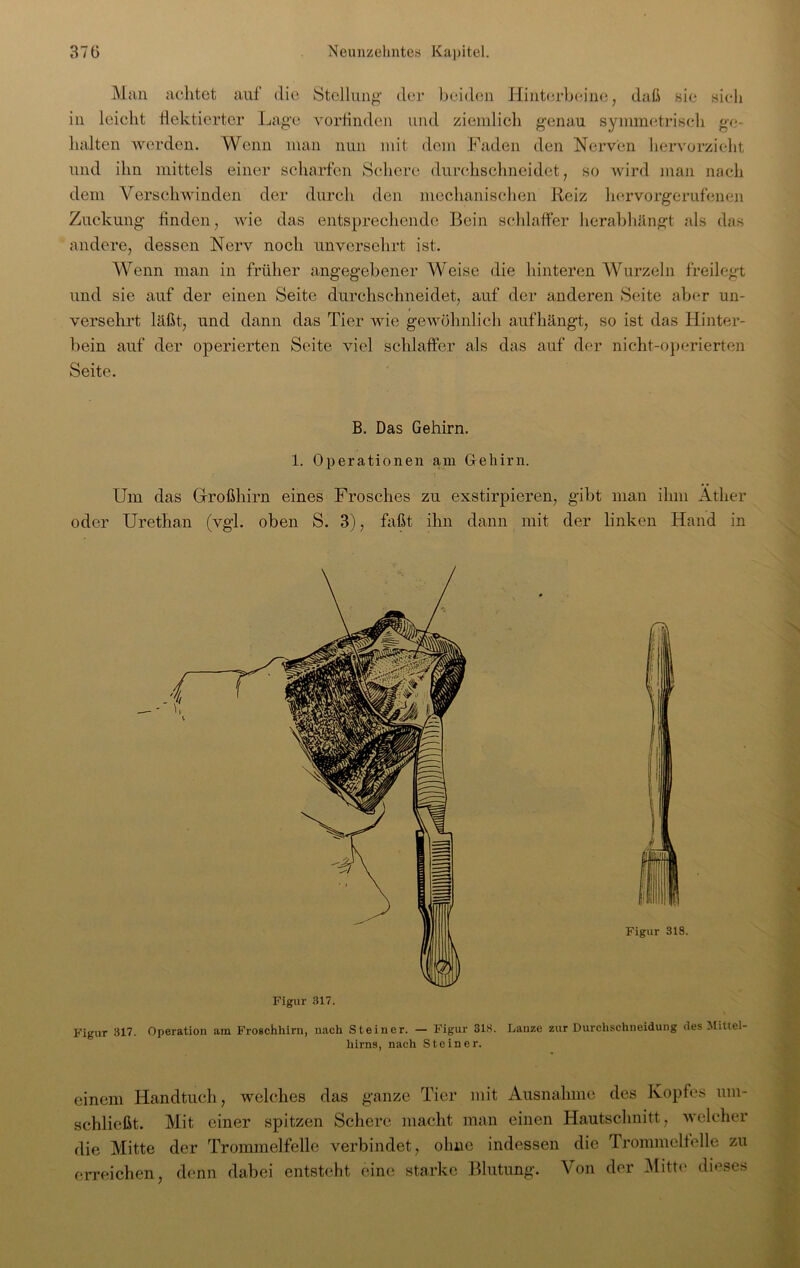 Man achtet auf die Stellung der beiden Hinterbeine, daß sie sich in leicht flektierter Lage vorfinden und ziemlich genau symmetrisch ge- halten werden. Wenn man nun mit dem Faden den Nerven hervorzieht und ihn mittels einer scharfen Schere durchschneidet, so wird inan nach dem Verschwinden der durch den mechanischen Reiz hervorgerufenen Zuckung finden, wie das entsprechende Bein schlaffer herabhängt als das andere, dessen Nerv noch unversehrt ist. Wenn man in früher angegebener Weise die hinteren Wurzeln freilegt und sie auf der einen Seite durchschneidet, auf der anderen Seite aber un- versehrt läßt, und dann das Tier wie gewöhnlich aufhängt, so ist das Hinter- bein auf der operierten Seite viel schlaffer als das auf der nicht-operierten Seite. B. Das Gehirn. 1. Operationen am Gehirn. Um das Großhirn eines Frosches zu exstirpieren, gibt man ihm Äther oder Urethan (vgl. oben S. 3), faßt ihn dann mit der linken Hand in Figur 317. Operation am Froschhirn, nach Steiner. — Figur 313. Lanze zur Durchschneidung des Mittel- hirns, nach Steiner. einem Handtuch, welches das ganze Tier mit Ausnahme des Kopfes um- schließt. Mit einer spitzen Schere macht man einen Hautschnitt, welcher die Mitte der Trommelfelle verbindet, ohne indessen die Trommelfelle zu erreichen, denn dabei entsteht eine starke Blutung. Von der Mitte dieses