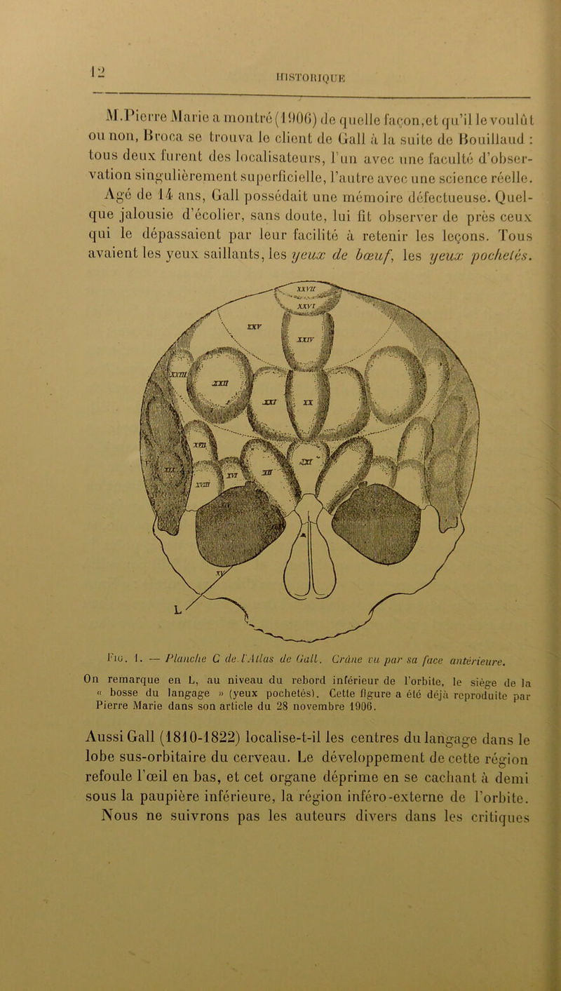 M. Pierre Marie a montré (1906) de quelle façon, et qu’il le voulu l ou non, Broca se trouva le client de Gall à la suite de Bouillaud : tous deux lurent des localisateurs, 1 un avec une faculté d’obser- vation singulièrement superficielle, l’autre avec une science réelle. Agé de 14 ans, Gali possédait une mémoire défectueuse. Quel- que jalousie d’écolier, sans doute, lui fit observer de près ceux qui le dépassaient par leur facilité à retenir les leçons. Tous avaient les yeux saillants, les yeux de bœuf\ les yeux poche lès. Fiu. 1. — Planche C de. IAllas de Gall. Crâne vu par sa face antérieure. On remarque en L, au niveau du rebord inférieur de l’orbite, le siège de la « bosse du langage » (yeux pochetés). Cette ligure a été déjà reproduite par Pierre Marie dans son article du 28 novembre 1906. xxni _ xxv r Aussi Gall (1810-1822) localise-t-il les centres du langage dans le lobe sus-orbitaire du cerveau. Le développement de cette région refoule l’œil en bas, et cet organe déprime en se cachant à demi sous la paupière inférieure, la région inféro-externe de l’orbite. Nous ne suivrons pas les auteurs divers dans les critiques