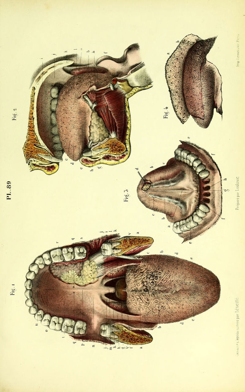 PL. 89 alur&jpâr Lé Veillé. Préparé par Ludovic. Imp.liernero;