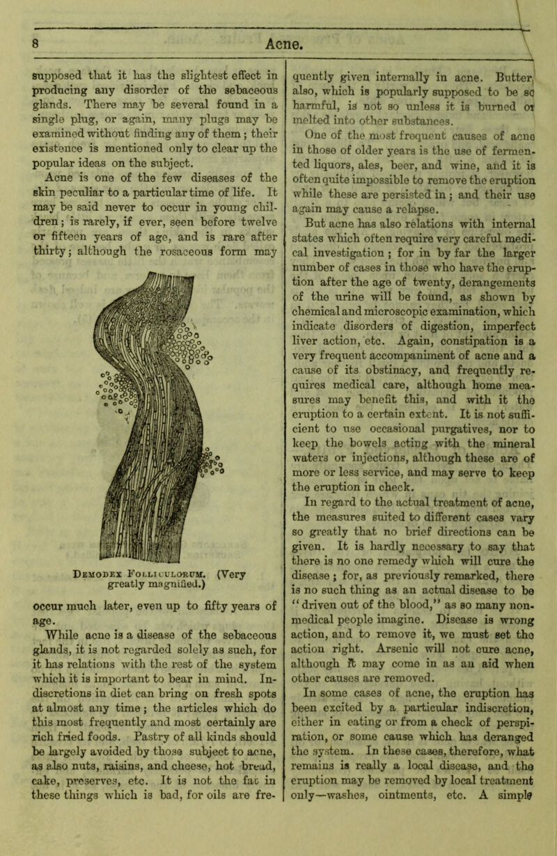 supposed tlmt it lias the slightest effect in producing any disorder of the sebaceous glands. There may he several found in a single plug, or again, many plugs may he examined without finding any of them; their existence is mentioned only to clear up the popular ideas on the subject. Acne is one of the few diseases of the skin peculiar to a particular time of life. It may be said never to occur in young chil- dren ; is rarely, if ever, seen before twelve or fifteen years of age, and is rare after thirty; although the rosaceous form may Dbmodex Foi-liculorum. (Very greatly magnified.) occur much later, even up to fifty years of age. While acne is a disease of the sebaceous glands, it is not regarded solely as such, for it has relations with the rest of the system which it is important to bear in mind. In- discretions in diet can bring on fresh spots at almost any time; the articles which do this most frequently and most certainly are rich fried foods. Pastry of all kinds should be largely avoided by those subject to acne, as also nuts, raisins, and cheese, hot bread, cake, preserves, etc. It is not the fac in these things which is bad, for oils are fre- quently given internally in acne. Birtter, also, which is popularly supposed to be so harmful, is not so unless it is burned or melted into other substances. One of the most frequent causes of acne in those of older years is the use of fermen- ted liquors, ales, beer, and wine, and it is often quite impossible to remove the eruption while these are persisted in ; and their use again may cause a relapse. But acne has also relations with internal states wliich often require very careful medi- cal investigation ; for in by far the larger number of cases in those who have the erup- tion after the age of twenty, derangements of the urine will be found, as shown by chemical and microscopic examination, which indicate disorders of digestion, imperfect liver action, etc. Again, constipation is a very frequent accompaniment of acne and a cause of its obstinacy, and frequently re- quires medical care, although home mea- sures may benefit this, and with it the eniption to a certain extent. It is not suffi- cient to use occasional purgatives, nor to keep the bowels acting with the mineral waters or injections, although these are of more or less service, and may serve to keep the eruption in check. In regard to the actual treatment of acne, the measures suited to different cases vary so gi’eatly that no brief directions can be given. It is hardly necessary to say tliat there is no one remedy wliich will cure the disease ; for, as previously remarked, there is no such thing as an actual disease to be “ driven out of the blood,” as so many non- medical people imagine. Disease is wrong action, and to remove it, we must set the action right. Arsenic will not cure acne, although Jt may come in as an aid when other causes are removed. In some cases of acne, the eruption has been excited by a particular indiscretion, either in eating or from a check of perspi- ration, or some cause which has deranged the system. In these cases, therefore, what remains is really a local disea^, and the eruption may be removed by local treatment only—washes, ointments, etc. A simple