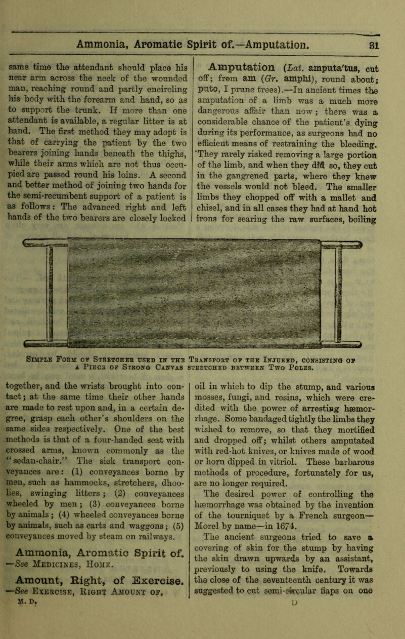 same time the attendant should place his near arm across the neck of the wounded man, reaching round and partly encircling his body with the forearm and hand, so as to support the trunk. If more than one attendant is available, a regular litter is at hand. The first method they may adopt is that of can’ying the patient by the two bearers joining hands beneath the thighs, wliile their arms which are not thus occu- pied are passed round his loins. A second and better method of joining two hands for the semi-recumbent support of a patient is as follows: The advanced right and left hands of the two bearers are closely locked Amputation (Lat. amputa'tus, cut off; from am (Qr. amphi), round aboutj puto, I prune trees).—In ancient times the amputation of a limb was a much more dangerous affair than now; there was a considerable chance of the patient’s dying during its performance, as surgeons had no efficient means of restraining the bleeding. 'They rarely risked removing a large portion of the limb, and when they did so, they cut in the gangrened parts, where they knew the vessels would not bleed. The smaller limbs they chopped off with a mallet and chisel, and in all cases they had at hand hot irons for searing the raw surfaces, boiling Simple Foem op Sthetchee used iu the Tbahspoet op the Injured, consistino op A Piece op Steono Canvas stretched between Two Poles. together, and the wrists brought into con- tact; at the same time their other hands are made to rest upon and, in a certain de- gree, gi*asp each other’s shoulders on the same sides respectively. One of the best methods is that of a four-handed seat with crossed arms, known commonly as the “sedan-chair.” The sick transport con- veyances are; (1) conveyances borne by men, such as hammocks, stretchers, dhoo- lies, swinging litters; (2) conveyances wheeled by men; (3) conveyances borne by animals ; (4) wheeled conveyances borne by animals, such as carts and waggons; (5) conveyances moved by steam on railways. Ammonia, Aromatic Spirit of. —See Medicines, IIojie. Amount, Right, of Exercise. —See Exercise, Right Amount of, M. D. oil in which to dip the stump, and various mosses, fungi, and resins, which were cre- dited with the power of arresting haemor- rhage. Some bandaged tightly the limbs they wished to remove, so tliat they mortified and dropped off; whilst others amputated with red-hot knives, or knives made of wood or horn dipped in vitriol. These barbarous methods of procedure, fortunately for us, are no longer required. The desired power of controlling the haemorrhage was obtained by the invention of the tourniquet by a French surgeon— Morel by name—in 1674. The ancient sui’geons tried to save a covering of skin for the stump by having the skin drawn upwards by an assistant, previously to using the knife. Towards the close of the seventeenth centmy it was suggested to cut semi-e4rcular flaps on ono D