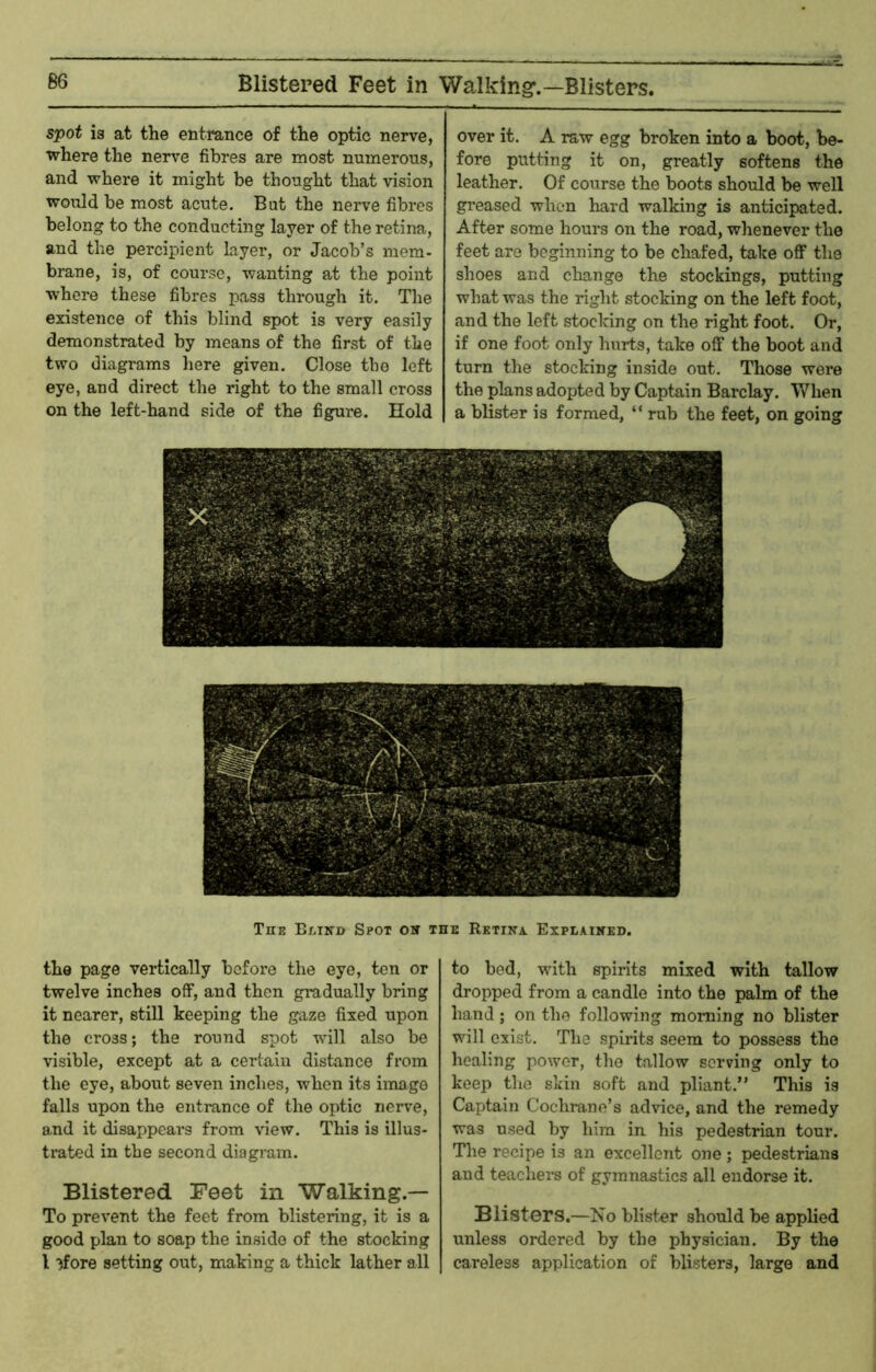 Blistered Feet in Walking’.—Blisters. spot is at the entrance of the optic nerve, where the nerve fibres are most numerous, and where it might be thought that vision would be most acute. But the nerve fibres belong to the conducting layer of the retina, and the percipient layer, or Jacob’s mem- brane, is, of course, wanting at the point vrhere these fibres pass through it. The existence of this blind spot is very easily demonstrated by means of the first of the two diagrams liere given. Close the left eye, and direct the right to the small cross on the left-hand side of the figure. Hold over it. A raw egg broken into a boot, be- fore putting it on, greatly softens the leather. Of course the boots should be well greased when hard walking is anticipated. After some hours on the road, whenever the feet are beginning to be chafed, take off the shoes and change the stockings, putting what was the right stocking on the left foot, and the left stocking on the right foot. Or, if one foot only hurts, take off the boot and turn the stocking inside out. Those were the plans adopted by Captain Barclay. When a blister is formed, “ rub the feet, on going The Bliitd Spot oh the Rktiha Explaiked. the page vertically before the eye, ten or twelve inches off, and then gradually bring it nearer, still keeping the gaze fixed upon the cross; the round spot will also be visible, except at a certain distance from the eye, about seven inches, when its image falls upon the entrance of the optic nerve, and it disappears from view. This is illus- trated in the second diagram. Blistered Feet in Walking.— To prevent the feet from blistering, it is a good plan to soap the inside of the stocking I ffore setting out, making a thick lather all to bed, with spirits mixed with tallow dropped from a candle into the palm of the hand ; on the following morning no blister will exist. The spirits seem to possess the healing power, the tallow serving only to keep the skin soft and pliant.” This is Captain Cochrane’s advice, and the remedy was used by him in his pedestrian tour. The recipe is an excellent one; pedestrians and teachers of gymnastics all endorse it. Blisters.—No blister should be applied unless ordered by the physician. By the careless application of blisters, large and