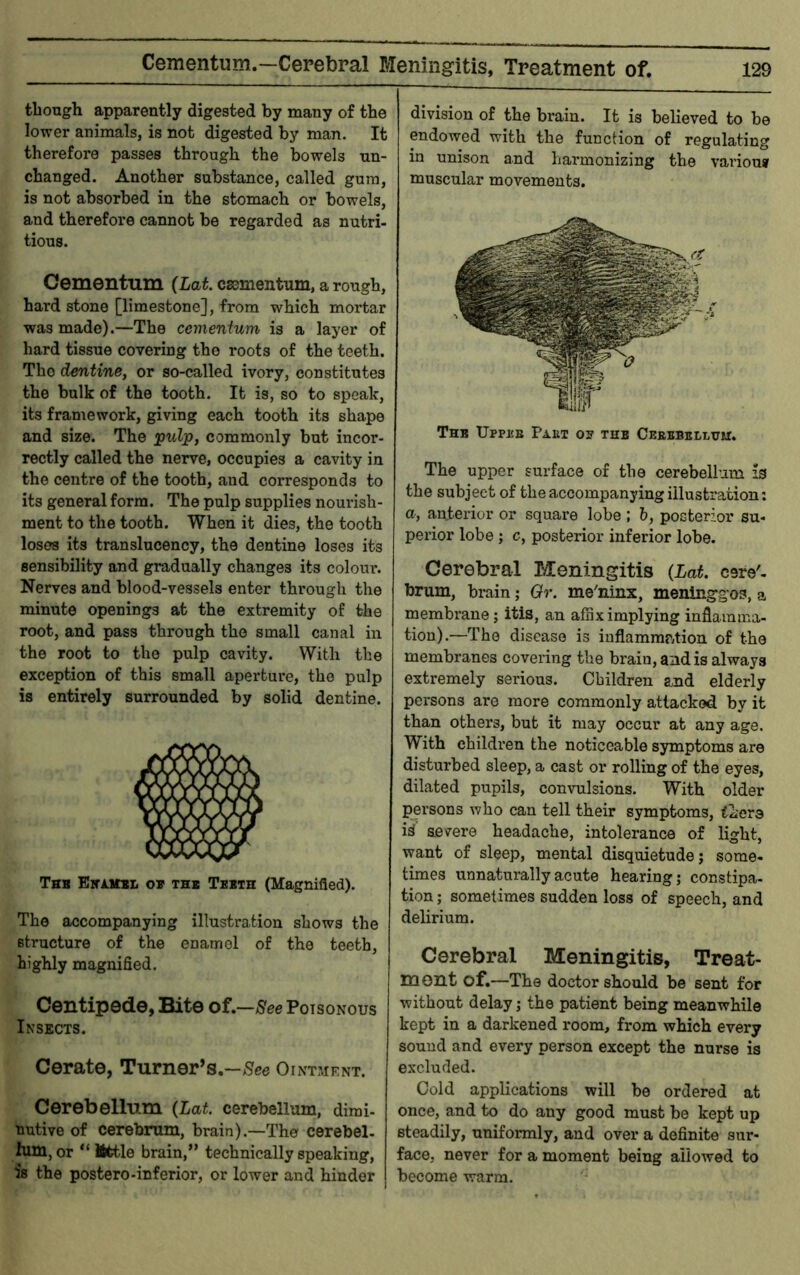 Cementum.—Cerebral Meningitis, Treatment of. though apparently digested by many of the lower animals, is not digested by man. It therefore passes through the bowels un- changed. Another substance, called gum, is not absorbed in the stomach or bowels, and therefore cannot be regarded as nutri- tious. Cementum {Lat. csementnm, a rough, hard stone [limestone], from which mortar was made).—The cementum is a layer of hard tissue covering the roots of the teeth. The dentine, or so-called ivory, constitutes the bulk of the tooth. It is, so to speak, its framework, giving each tooth its shape and size. The ^pulip, commonly but incor- rectly called the nerve, occupies a cavity in the centre of the tooth, and corresponds to its general form. The pulp supplies nourish- ment to the tooth. When it dies, the tooth loses its translucency, the dentine loses its sensibility and gradually changes its colour. Nerves and blood-vessels enter through the minute openings at the extremity of the root, and pass through the small canal in the root to the pulp cavity. With the exception of this small aperture, the pulp is entirely surrounded by solid dentine. Thb Eirimn ob thb Tbbth (Magnified). The accompanying illustration shows the structure of the enamel of the teeth, highly magnified. Centipede, Bite of,—See Poisonous Insects. Cerate, Turner’s.—Ointment. Cerebellum {Lat cerebellum, dimi- nutive of cerebrum, brain).—The cerebel- lum, or “Iftttle brain,” technically speaking, is the postero-inferior, or lower and hinder division of the brain. It is believed to be endowed with the function of regulating in unison and harmonizing the various muscular movements. Thb Uppbb Fakt ob the Ceeebellum. The upper surface of the cerebellum is the subject of the accompanying illustration; a, an.tei’ior or squai*e lobe ; h, posterior su- perior lobe ; c, posterior inferior lobe. Cerebral Meningitis {Lat. cere'- brum, brain; Or. me'ninx, meninggos, a membrane; itis, an affix implying inflamma- tion).—The disease is inflammation of the membranes covering the brain, and is always extremely serious. Children and elderly persons are more commonly attacked by it than others, but it may occur at any age. With childi’en the noticeable symptoms are disturbed sleep, a cast or rolling of the eyes, dilated pupils, convulsions. With older persons who can tell their symptoms, tlere i^ aei^ere headache, intolerance of light, want of sleep, mental disquietude; some- times unnaturally acute hearing; constipa- tion ; sometimes sudden loss of speech, and delirium. Cerebral Meningitis, Treat- ment of.—The doctor should be sent for without delay; the patient being meanwhile kept in a darkened room, from which every sound and every person except the nurse is excluded. Cold applications will be ordered at once, and to do any good must be kept up steadily, uniformly, and over a definite sur- face, never for a moment being allowed to become warm.