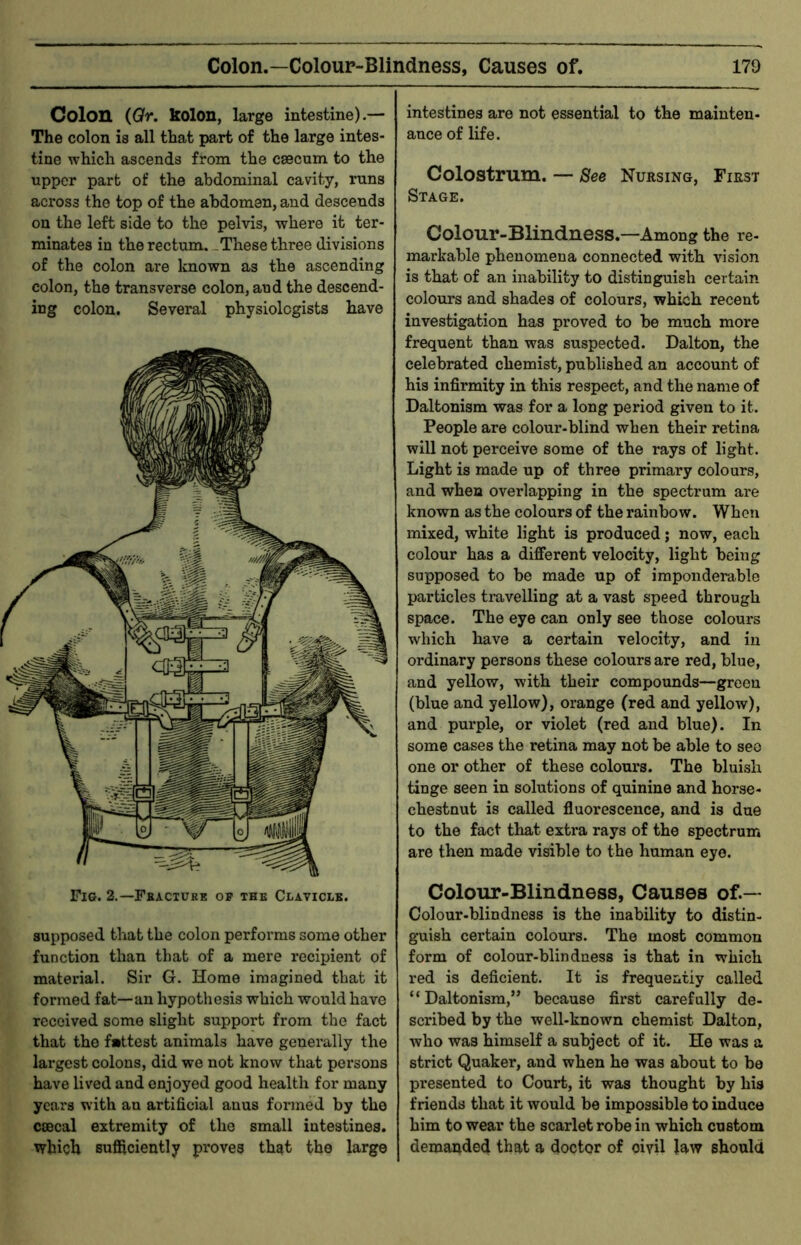 Colon (Qr. kolon, large intestine).— The colon is all that part of the large intes- tine which ascends from the caecum to the upper part of the abdominal cavity, runs across the top of the abdomen, and descends on the left side to the pelvis, where it ter- minates in the rectum. -These three divisions of the colon are known as the ascending colon, the transverse colon, and the descend- ing colon. Several physiologists have supposed that the colon performs some other function than that of a mere recipient of material. Sir G. Home imagined that it formed fat—an hypothesis which would have received some slight support from the fact that the fattest animals have generally the largest colons, did we not know that persons have lived and enjoyed good health for many years with an artificial anus formed by the ccBcal extremity of the small intestines, which sufficiently proves that the large intestines are not essential to the mainten- ance of life. Colostrum. — See Nursing, First Stage. Colour-Blindness.—Among the re- markable phenomena connected with vision is that of an inability to distinguish certain- colours and shades of colours, which recent investigation has proved to be much more frequent than was suspected. Dalton, the celebrated chemist, published an account of his infirmity in this respect, and the name of Daltonism was for a long period given to it. People are colour-blind when their retina will not perceive some of the rays of light. Light is made up of three primary colours, and when overlapping in the spectrum are known as the colours of the rainbow. When mixed, white light is produced; now, each colour has a different velocity, light being supposed to be made up of imponderable particles travelling at a vast speed through space. The eye can only see those colours which have a certain velocity, and in ordinary persons these colours are red, blue, and yellow, with their compounds—green (blue and yellow), orange (red and yellow), and purple, or violet (red and blue). In some cases the retina may not be able to see one or other of these colours. The bluish tinge seen in solutions of quinine and horse- chestnut is called fluorescence, and is due to the fact that extra rays of the spectrum are then made visible to the human eye. Colour-Blindness, Causes of.— Colour-blindness is the inability to distin- guish certain colours. The most common form of colour-blindness is that in which red is deficient. It is frequently called “Daltonism,” because first carefully de- scribed by the well-known chemist Dalton, who was himself a subject of it. He was a strict Quaker, and when he was about to be presented to Court, it was thought by his friends that it would be impossible to induce him to wear the scarlet robe in which custom demanded that a doctor of civil law should