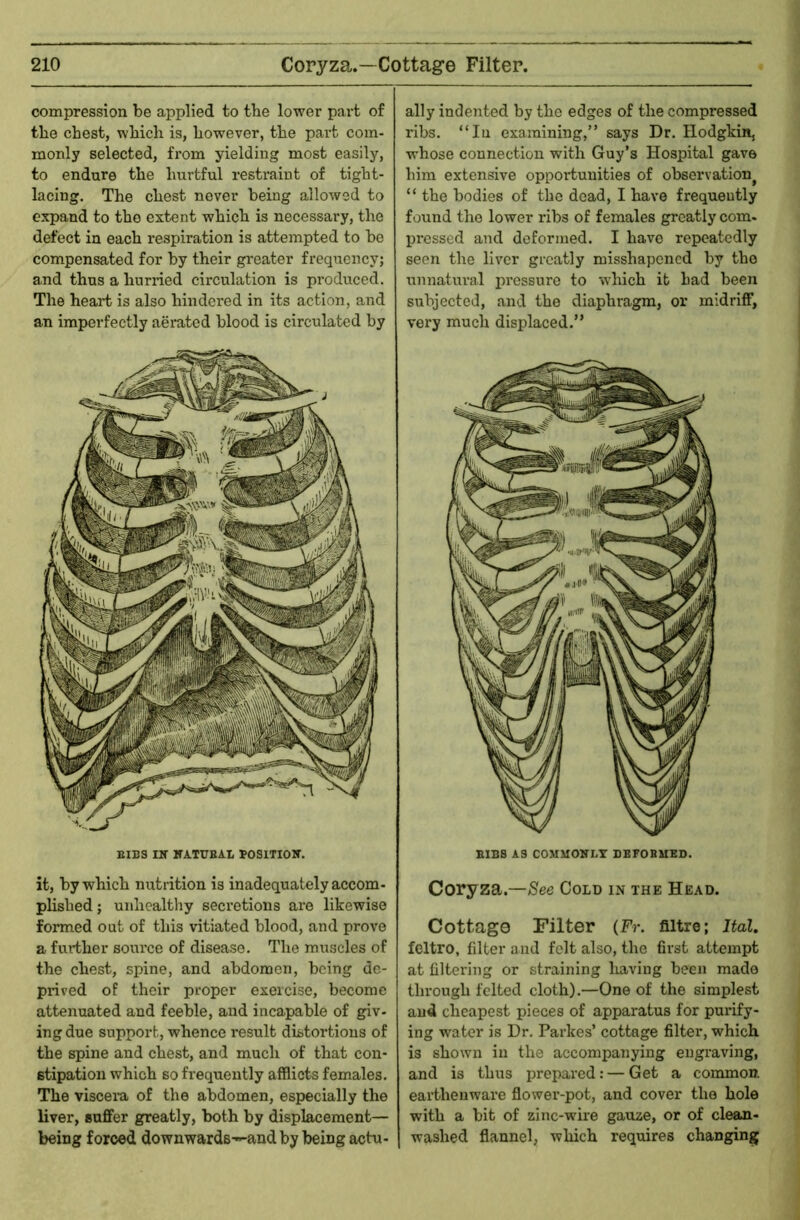 compression be applied to the lower part of the chest, which is, however, the part com- monly selected, from yielding most easily, to endure the hurtful restraint of tight- lacing. The chest never being allowed to expand to the extent which is necessary, the defect in each respiration is attempted to be compensated for by their greater frequency; and thus a hurried circulation is produced. The heart is also hindered in its action, and an imperfectly aerated blood is circulated by BIBS Iir KATUEAl BOSITIOW. it, by which nutrition is inadequately accom- plished ; unhealthy secretions are likewise formed out of this vitiated blood, and prove a further source of disease. The muscles of the chest, spine, and abdomen, being de- praved of their proper exercise, become attenuated and feeble, and incapable of giv- ing due support, whence result distortions of the spine and chest, and much of that con- stipation which so frequently afflicts females. The viscei-a of the abdomen, especially the liver, suffer greatly, both by displacement— being forced downwards-^and by being actu- ally indented by the edges of the compressed ribs. “In examining,” says Dr. Hodgkin, whose connection with Guy’s Hospital gave him extensive oppor-tunities of observation^ “ the bodies of the dead, I have frequently found the lower ribs of females greatly corn- pressed and deformed. I have repeatedly seen the liver greatly misshapened by the unnatural pressure to which it had been subjected, and the diaphragm, or midriff, very much displaced.” BIBS AS COMMONLY DEFOBMED. Coryza.—Cold in the Head. Cottage Filter (Fr. fiitre; Ital. feltro, filter and felt also, the first attempt at filtering or straining having been made through felted cloth).—One of the simplest and cheapest pieces of apparatus for pui'ify- ing water is Dr. Parkes’ cottage filter, which is shown in the accompanying engraving, and is thus prepared: — Get a common, earthenware flower-pot, and cover the hole with a bit of zinc-wire gauze, or of clean- washed flannel, which requires changing