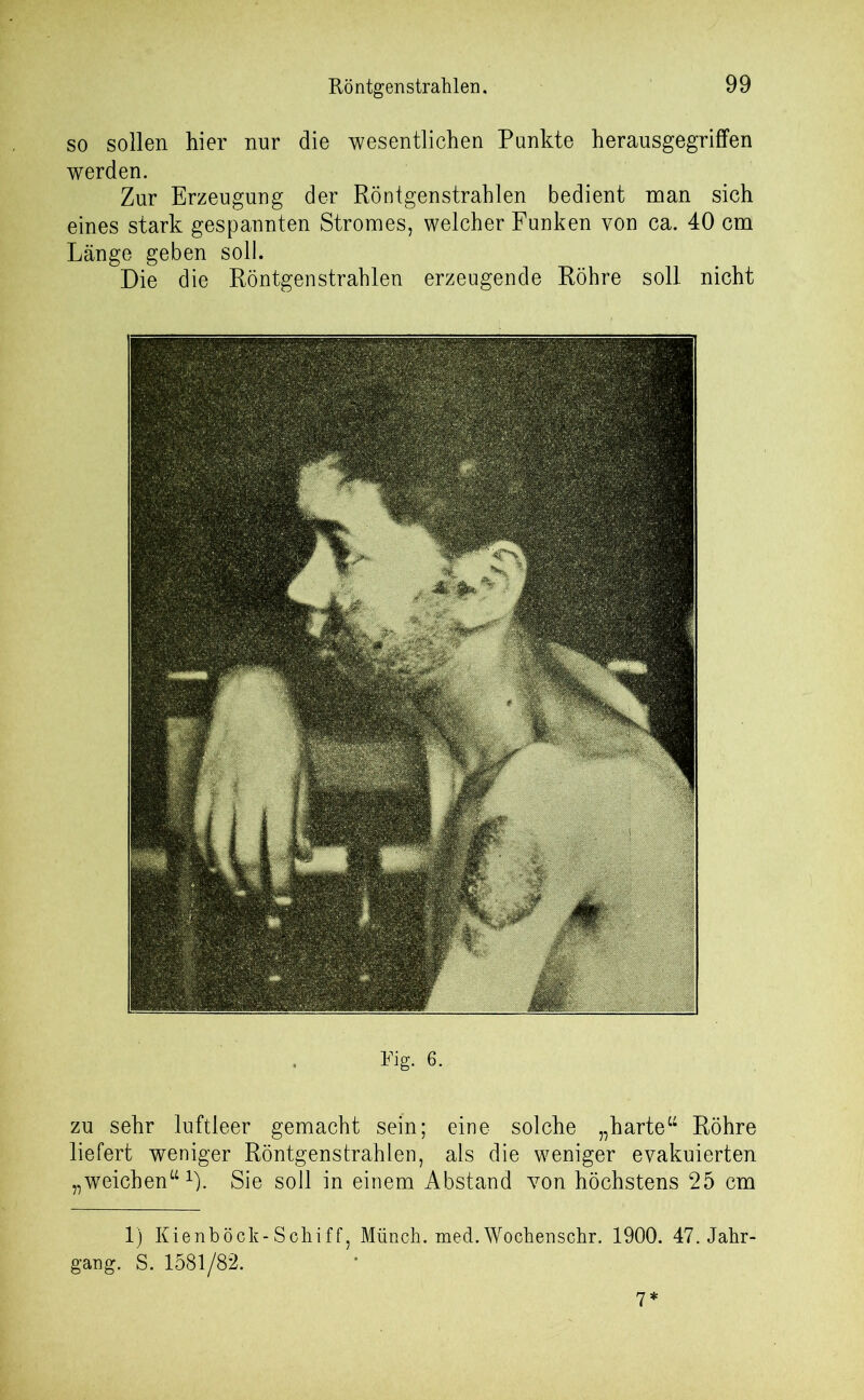so sollen hier nur die wesentlichen Punkte herausgegriffen werden. Zur Erzeugung der Röntgenstrahlen bedient man sich eines stark gespannten Stromes, welcher Funken von ca. 40 cm Länge geben soll. Die die Röntgenstrahlen erzeugende Röhre soll nicht Fig. 6. zu sehr luftleer gemacht sein; eine solche „harte“ Röhre liefert weniger Röntgenstrahlen, als die weniger evakuierten „weichen“1)- Sie soll in einem Abstand von höchstens 25 cm 1) Kienböck-Schiff, Münch. med.Wochenschr. 1900. 47. Jahr- gang. S. 1581/82. 7*