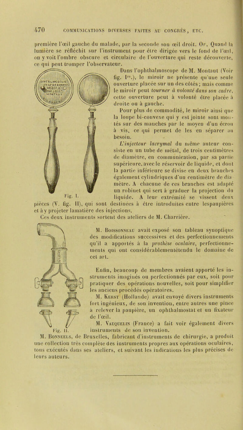 première l’œil gauche du malade, par la seconde son œil droit. Or, Quand la lumière se réfléchit sur l'instrument pour être dirigée vers le fond de l’œil, on y voit l’ombre obscure et circulaire de l’ouverture qui reste découverte, ce qui peut tromper l’observateur. Dans l’opluhalmoscope de M. Montaut (Voir fig. lrc.), le miroir ne présente qu’une seule ouverture placée sur un des côtés ; mais comme le miroir peut tourner à volonté dans son cadre, celle ouverture peut à volonté être placée à droite ou à gauche. Pour plus de commodité, le miroir ainsi que la loupe bi-convexe qui y est jointe sont mon- tés sur des manches par le moyen d’un écrou à vis, ce qui permet de les en séparer au besoin. L'injecleur lacrymal du même auteur con- siste en un tube de métal, de trois centimètres de diamètre, en communication, par sa parlic supérieure, avec le réservoir de liquide, et dont la partie inférieure se divise en deux branches également cylindriques d'un centimètre de dia mètre. A chacune de ces branches est adapté un robinet qui sert à graduer la projection du liquide. A leur extrémité se vissent deux pièces (V. fig. Il), qui sont destinées à être introduites entre lespaupières et à y projeter lamatière des injections. Ces deux instruments sortent des ateliers de M. Charrière. M. Boissonneau avait exposé son tableau synoptique des modifications successives et des perfectionnements qu’il a apportés à la prothèse oculaire, perfectionne- ments qui ont considérablementétendu le domaine de cet art. Fis. I. Enfin, beaucoup de membres avaient apporté les in- struments imaginés ou perfectionnés par eux, soit pour pratiquer des opérations nouvelles, soit pour simplifier les anciens procédés opératoires. M. Keiist (Hollande) avait envoyé divers instruments fort ingénieux, de son invention, entre autres une pince a relever la paupière, un ophlhalmostal et un fixateur de l’œil. M. Vauquelin (France) a fait voir également divers instruments de son invention. M. Bonneels, de Bruxelles, fabricant d'instruments de chirurgie, a produit une collection très complète des instruments propres aux opérations oculaires, tous exécutés dans ses ateliers, et suivant les indications les plus précises de leurs auteurs.