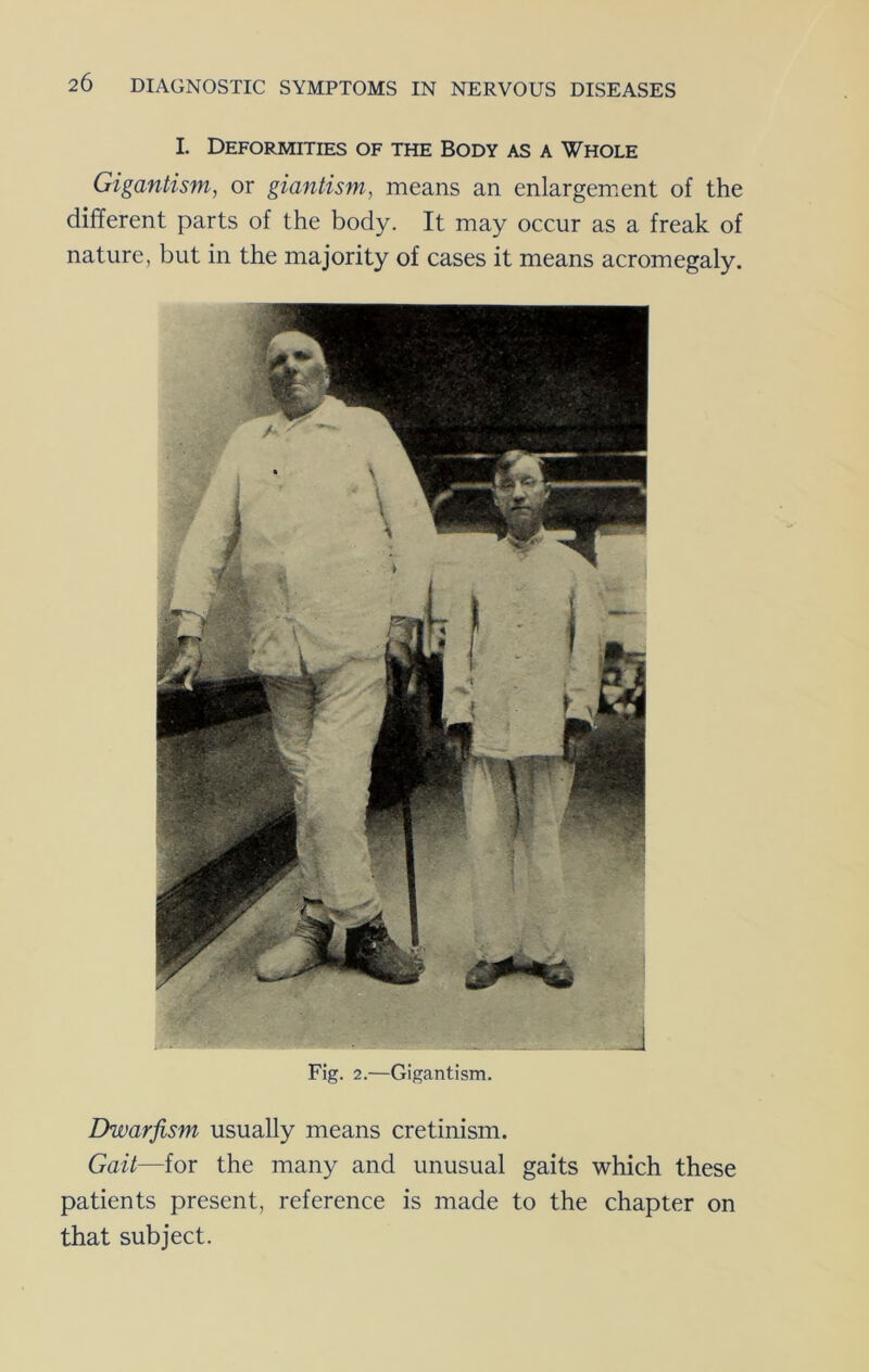 I. Deformities of the Body as a Whole Gigantism, or giantism, means an enlargement of the different parts of the body. It may occur as a freak of nature, but in the majority of cases it means acromegaly. Fig. 2.—Gigantism. Dwarfism usually means cretinism. Gait—for the many and unusual gaits which these patients present, reference is made to the chapter on that subject.