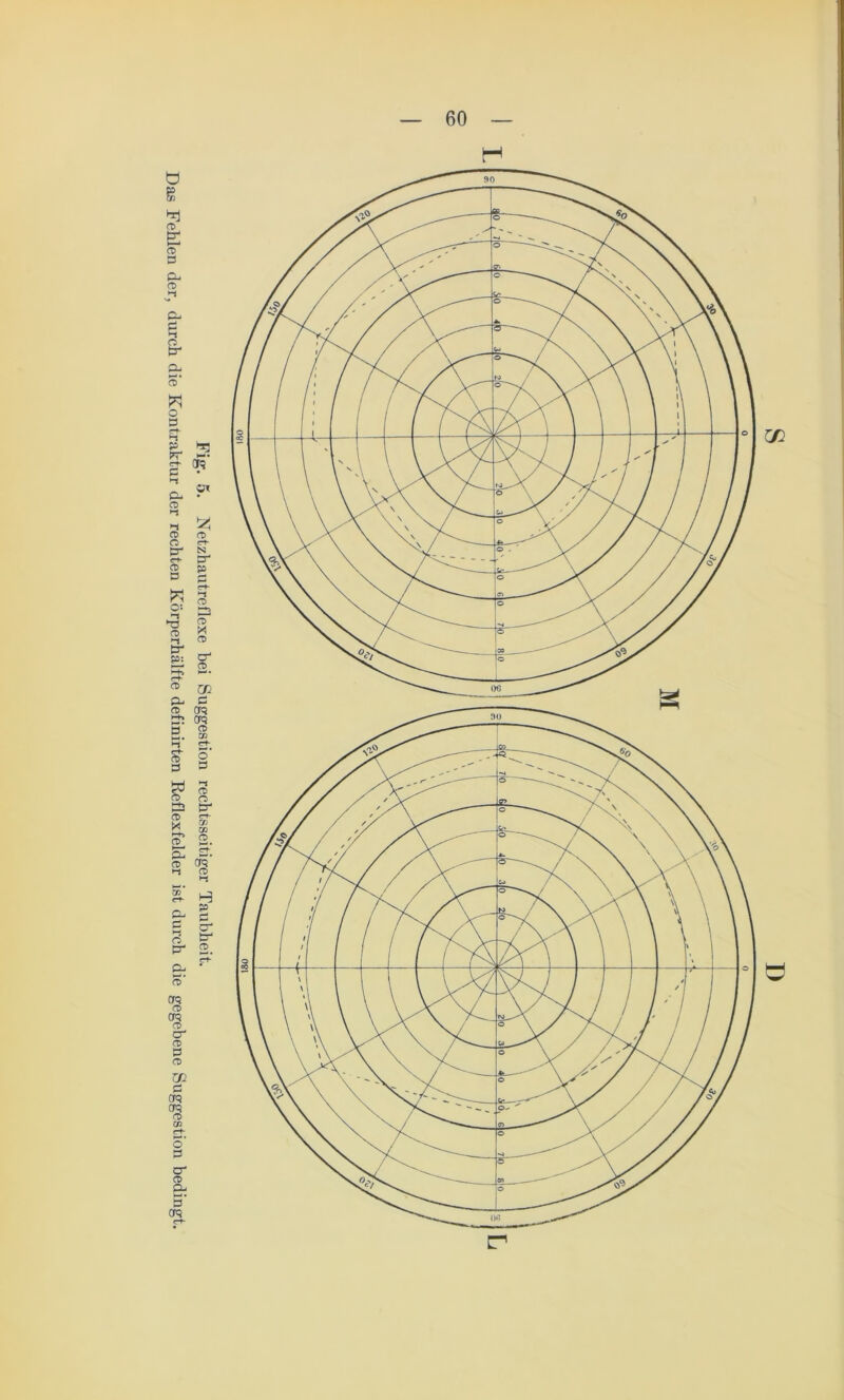 Fig. 5. Netzhautreflexe bei Suggestion rechtsseitiger Taubheit. Das Fehlen der, durch die Kontraktur der rechten Körperhälfte definirten Reflexfelder ist durch die gegebene Suggestion bedingt.