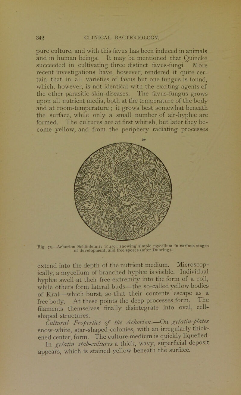 pure culture, and with this favus has been induced in animals and in human beings. It may be mentioned that Quincke succeeded in cultivating three distinct favus-fungi. More recent investigations have, however, rendered it quite cer- tain that in all varieties of favus but one fungus is found, which, however, is not identical with the exciting agents of the other parasitic skin-diseases. The favus-fungus grows upon all nutrient media, both at the temperature of the body and at room-temperature ; it grows best somewhat beneath the surface, while only a small number of air-hyphse are formed. The cultures are at first whitish, but later they be- come yellow, and from the periphery radiating processes Fig. 75.—Acliorion Schonleinii: X 450; showing simple mycelium in various stages of development, and free spores (after Duhring). extend into the depth of the nutrient medium. Microscop- ically, a mycelium of branched hyphae is visible. Individual hyphae swell at their free extremity into the form of a roll, while others form lateral buds—the so-called yellow bodies of Krai—which burst, so that their contents escape as a free body. At these points the deep processes form. The filaments themselves finally disintegrate into oval, cell- shaped structures. Cultural Properties of the Achonon.—On gelatin-plates snow-white, star-shaped colonies, with an irregularly thick- ened center, form. I he culture-medium is quickly liquefied. In gelatin stab-cultures a thick, wavy, superficial deposit appears, which is stained yellow beneath the surface.