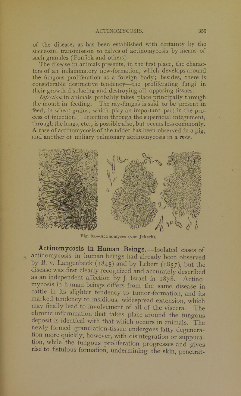 of the disease, as has been established with certainty by the successful transmission to calves of actinomycosis by means of such granules (Ponfick and others). The disease in animals presents, in the first place, the charac- ters of an inflammatory new-formation, which develops around the fungous proliferation as a foreign body; besides, there is considerable destructive tendency—the proliferating fungi in their growth displacing and destroying all opposing tissues. Infection in animals probably takes place principally through the mouth in feeding. The ray-fungus is said to be present in feed, in wheat-grains, which play an important part in the pro- cess of infection. Infection through the superficial integument, through the lungs, etc., is possible also, but occurs less commonly. A case of actinomycosis of the udder has been observed in a pig, and another of miliary pulmonary actinomycosis in a cow. Fig. 82.—Actinomyces (von Jalcsch). Actinomycosis in Human Beings.—Isolated cases of actinomycosis in human beings had already been observed by B. v. Langenbeck (1845) and by Lebert (1857), but the disease was first clearly recognized and accurately described as an independent affection by J. Israel in 1878. Actino- mycosis in human beings differs from the same disease in cattle in its slighter tendency to tumor-formation, and its marked tendency to insidious, widespread extension, which may finally lead to involvement of all of the viscera. The chronic inflammation that takes place around the fungous deposit is identical with that which occurs in animals. ^The newly foimed granulation-tissue undergoes fatty degenera- tion more quickly, however, with disintegration or suppura- tion, while the fungous proliferation progresses and gives rise to fistulous formation, undermining the skin, penetrat-